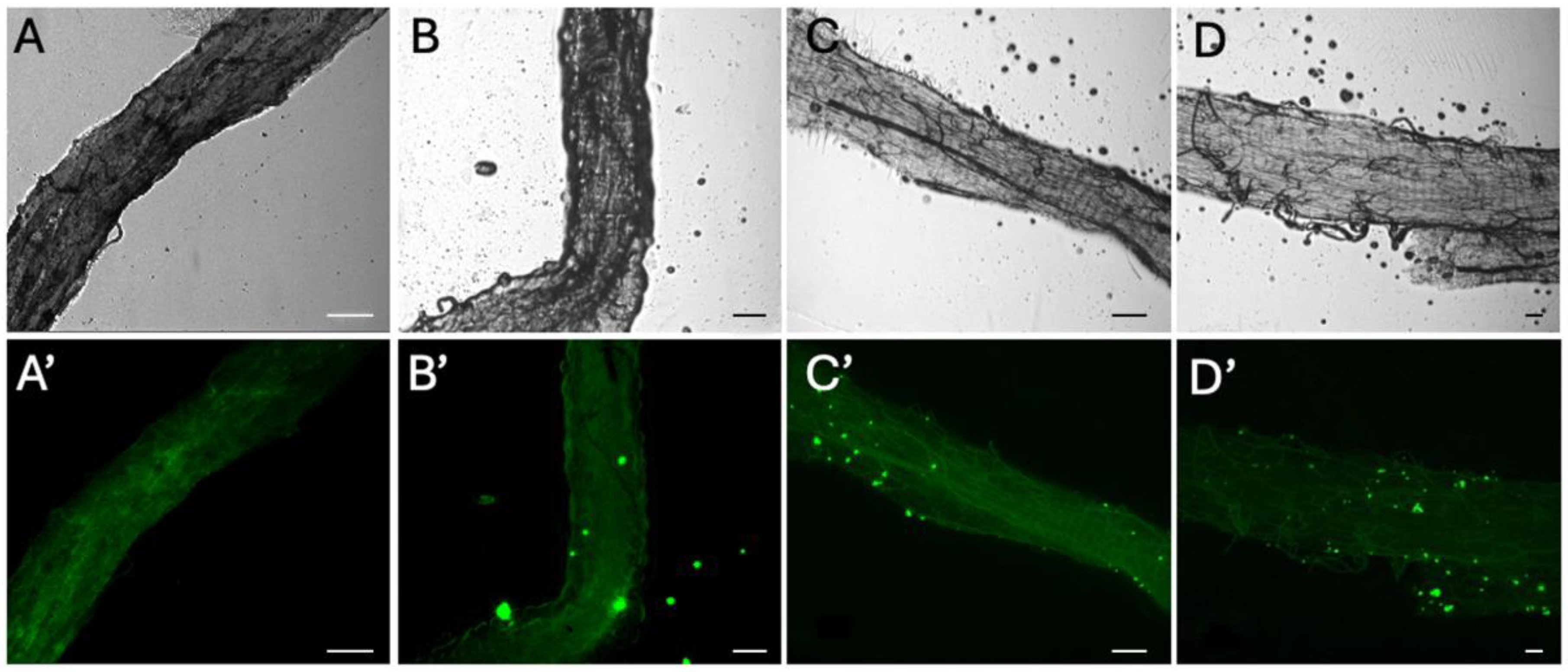 Microplastics 04 00022 g001