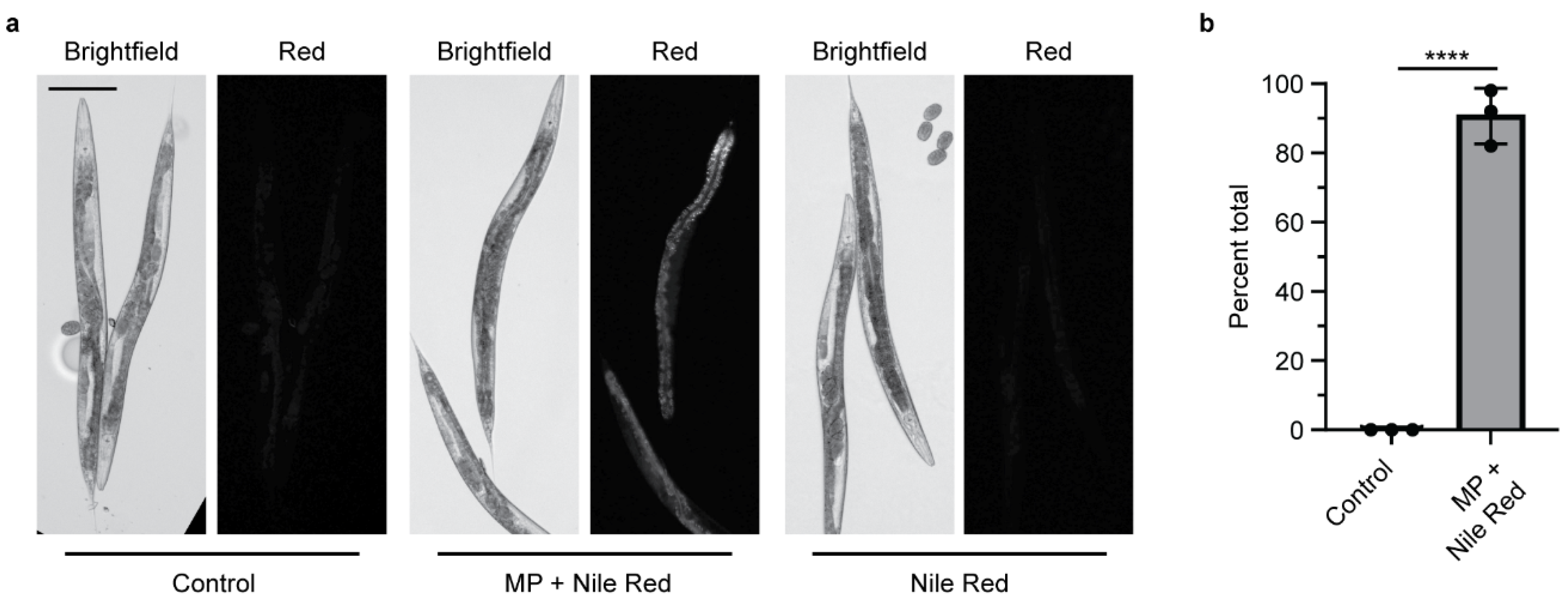 Microplastics 04 00096 g003
