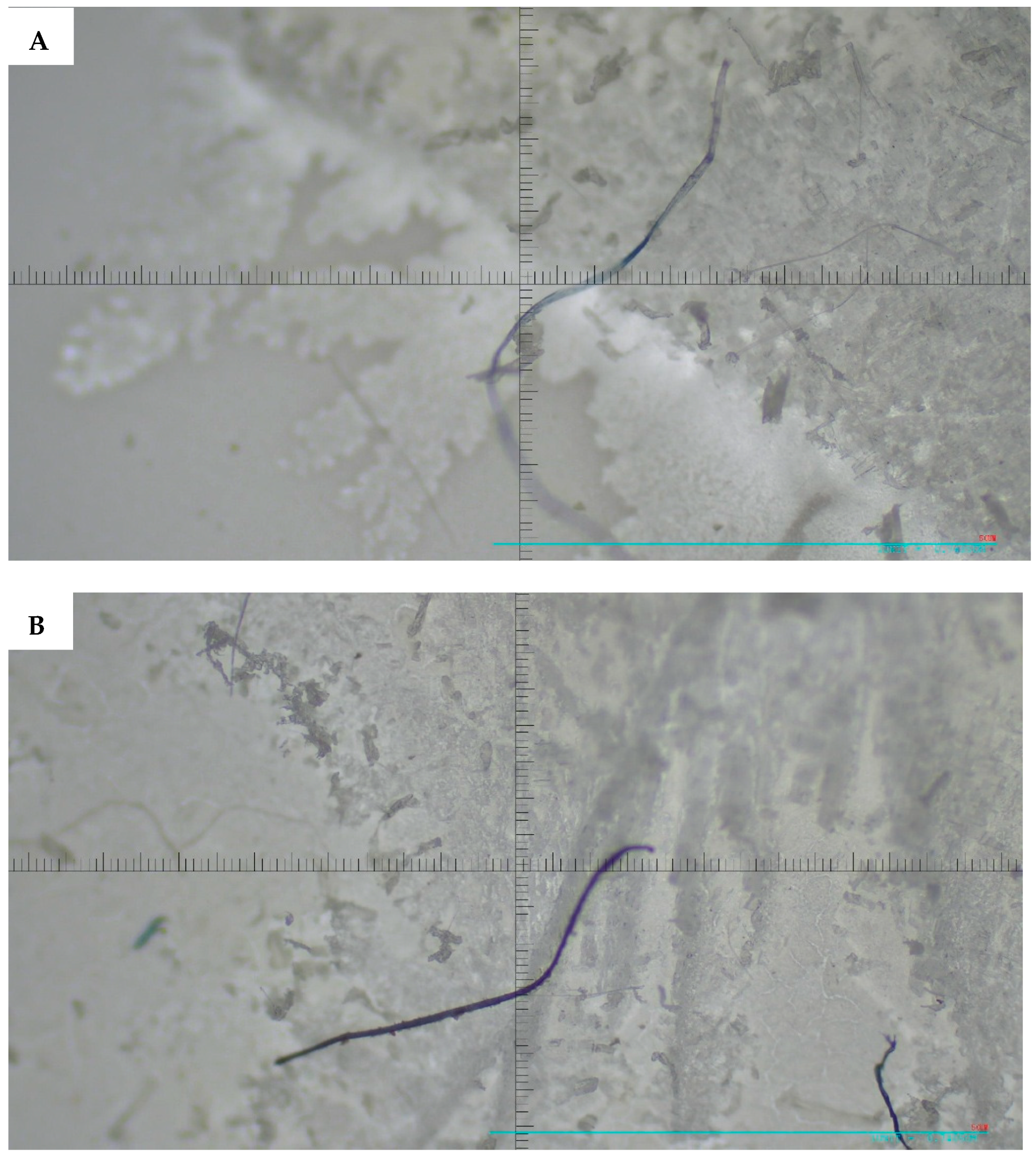 Microplastics 05 00125 g004a Microplastics 05 00125 g004a