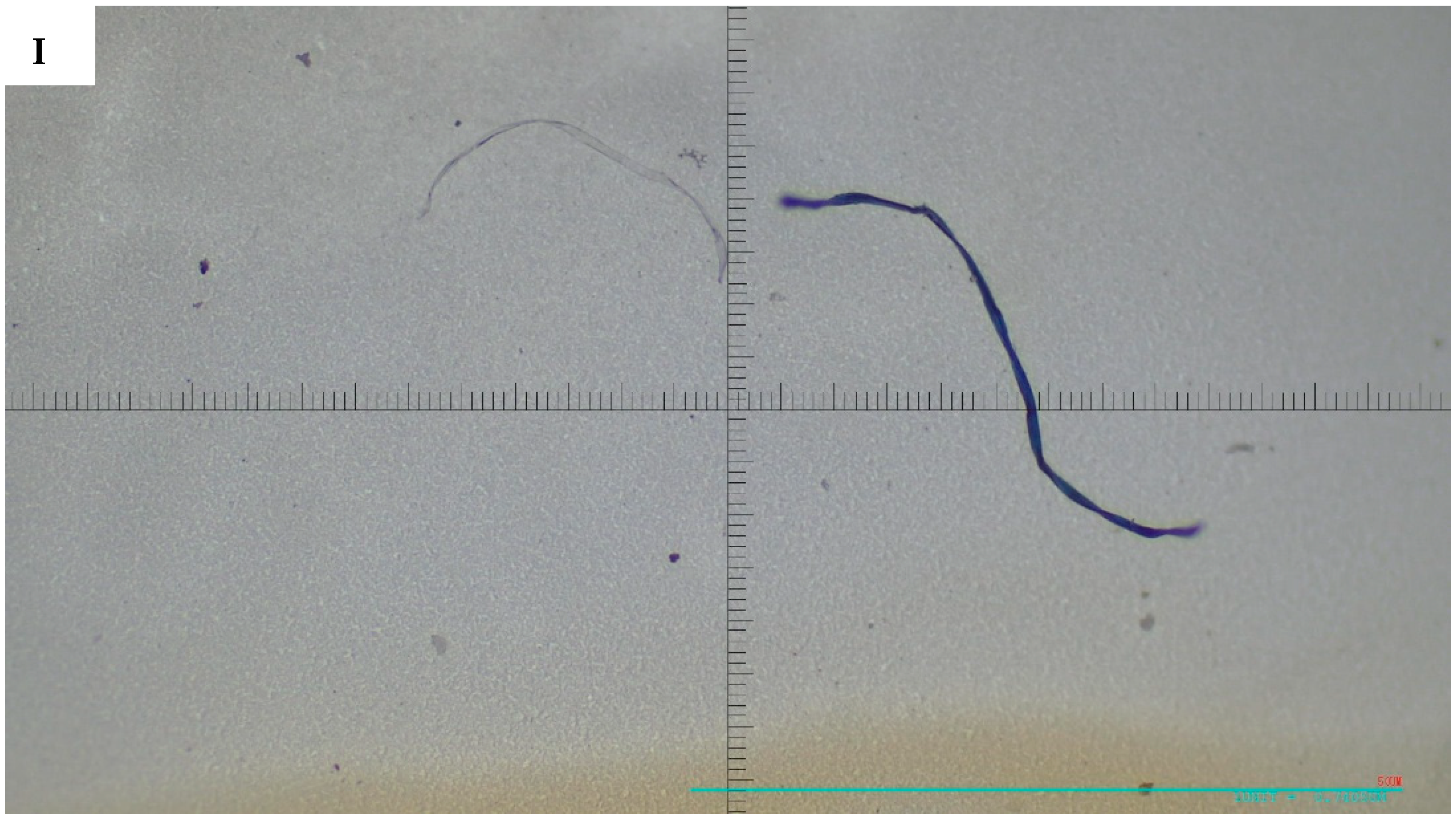 Microplastics 05 00125 g004d Microplastics 05 00125 g004d