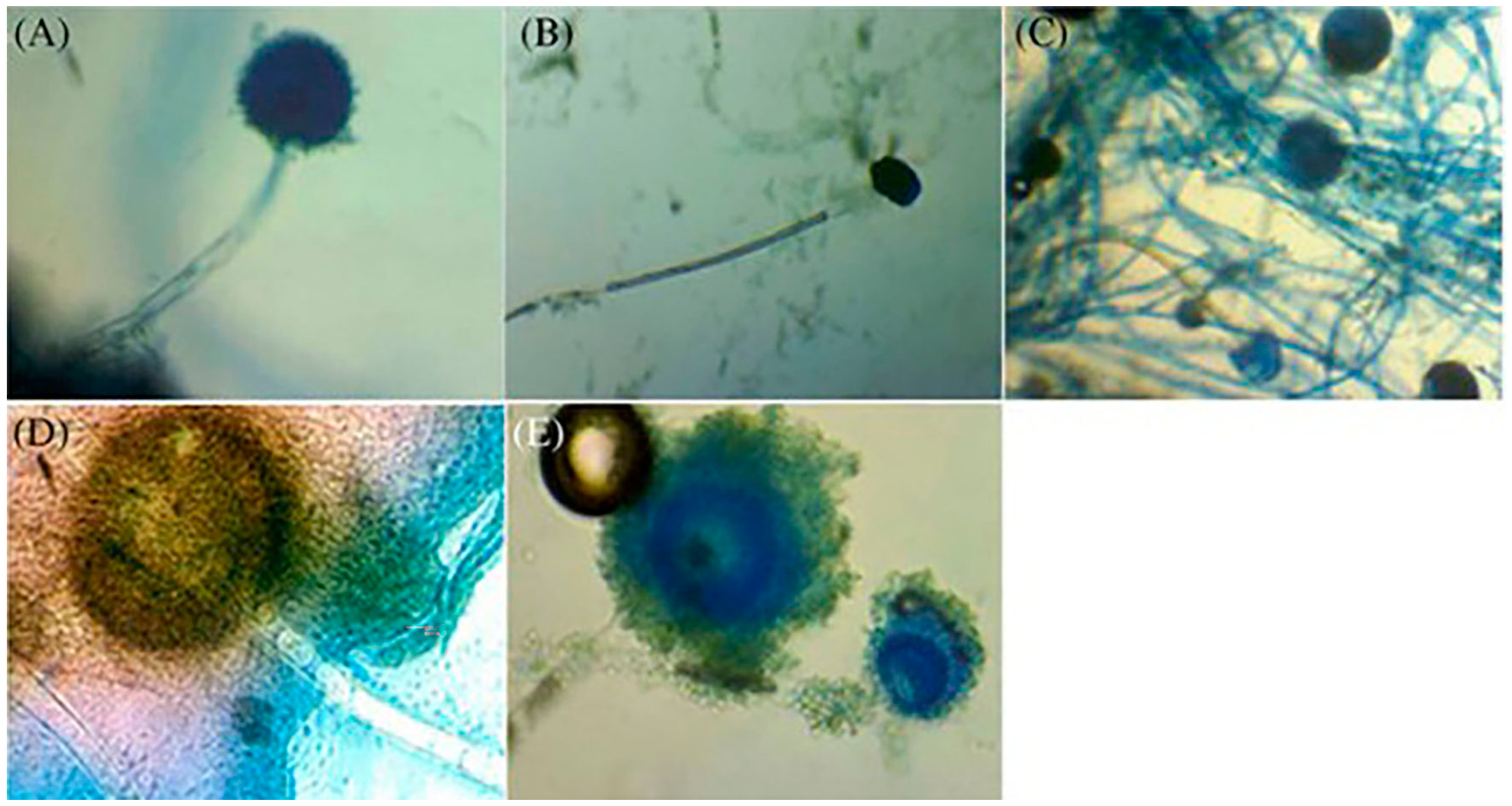 Microplastics 05 00138 g004 Microplastics 05 00138 g004