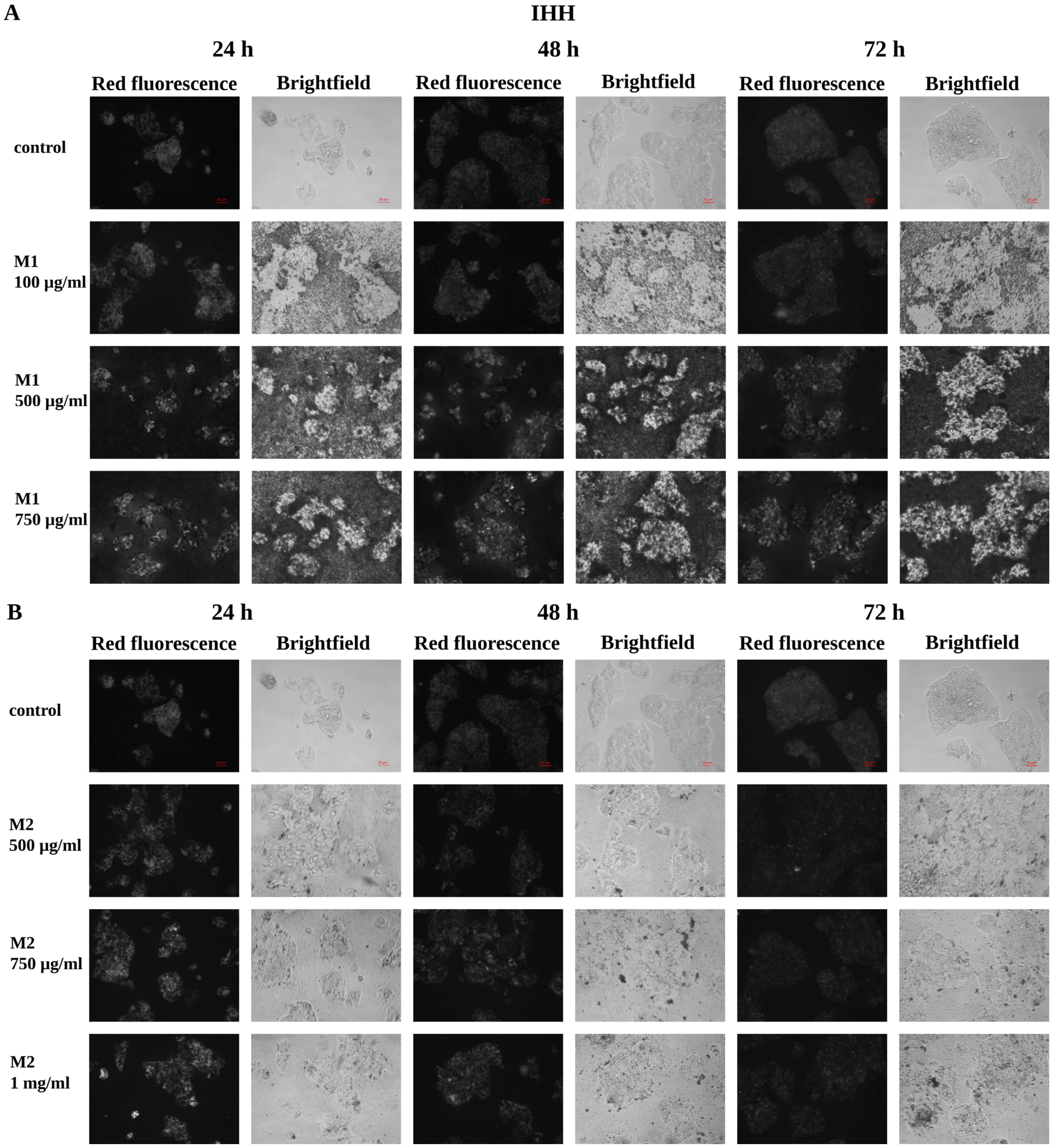 Microplastics 05 00169 g002 Microplastics 05 00169 g002