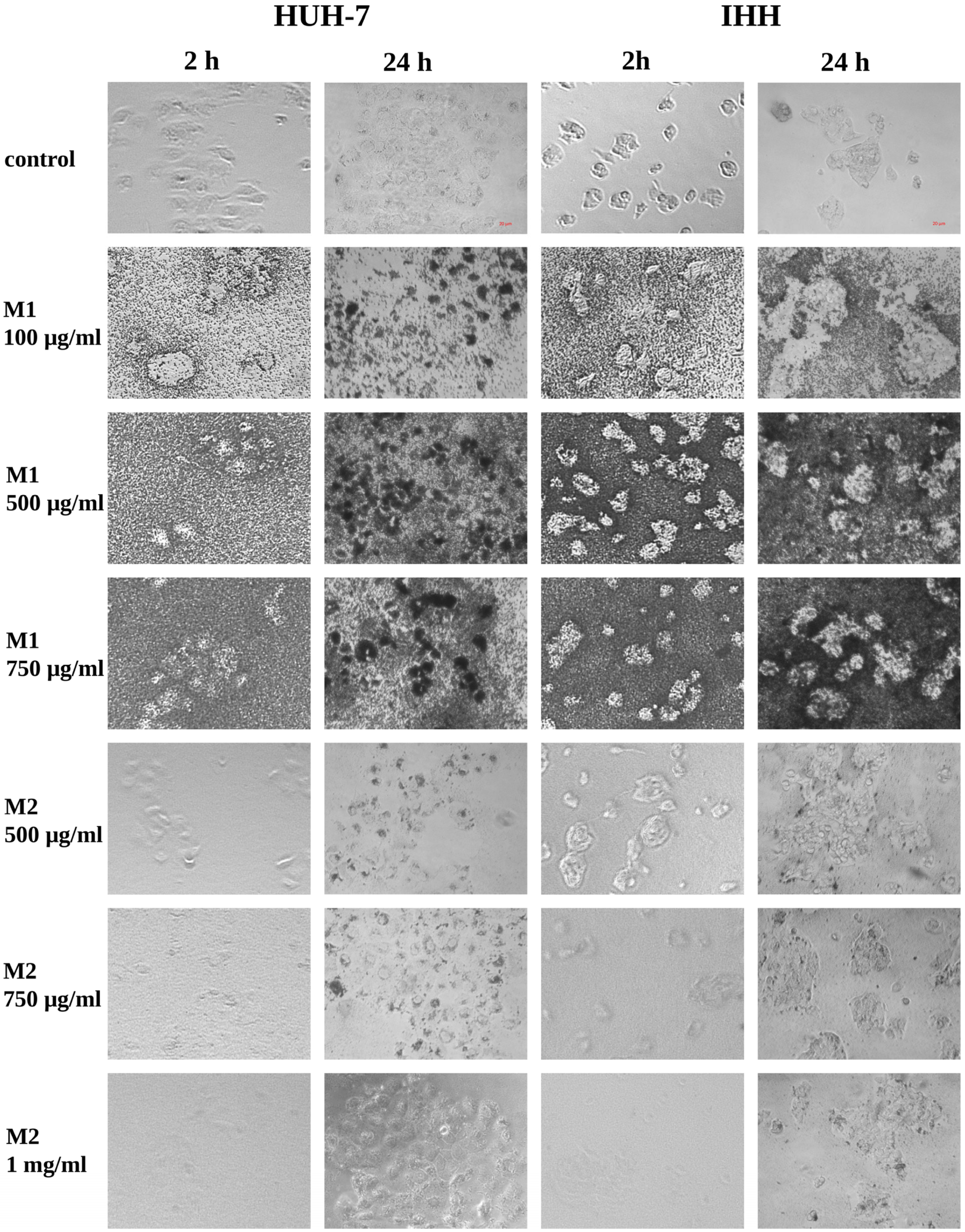 Microplastics 05 00169 g003 Microplastics 05 00169 g003