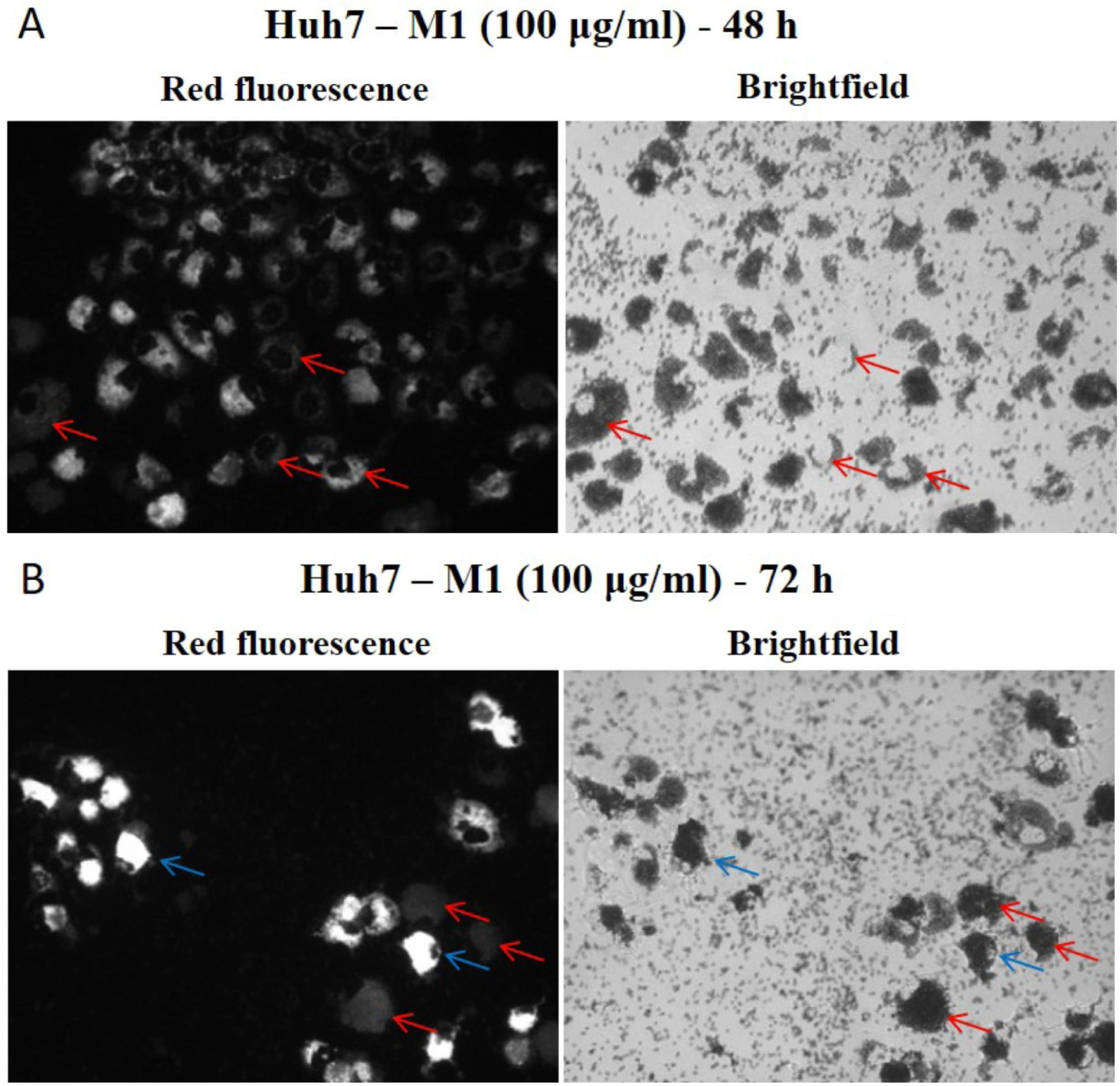 Microplastics 05 00169 g004 Microplastics 05 00169 g004