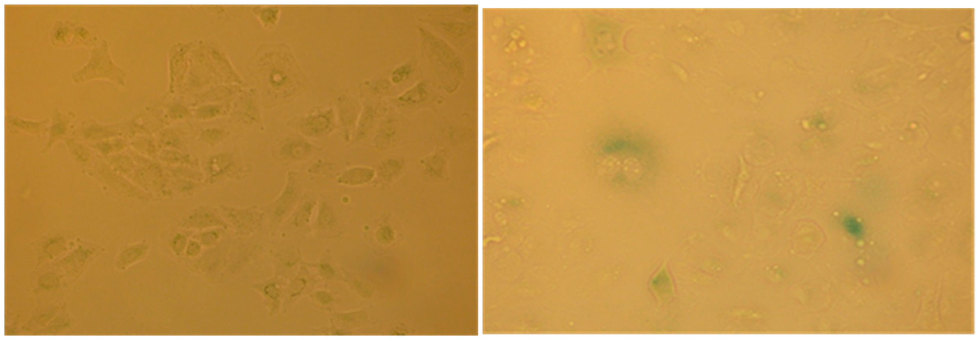 Molecules 21 00395 g012