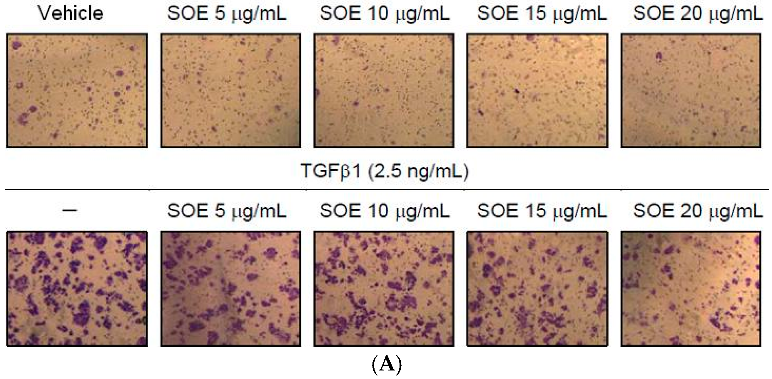 Molecules 21 01021 g004a