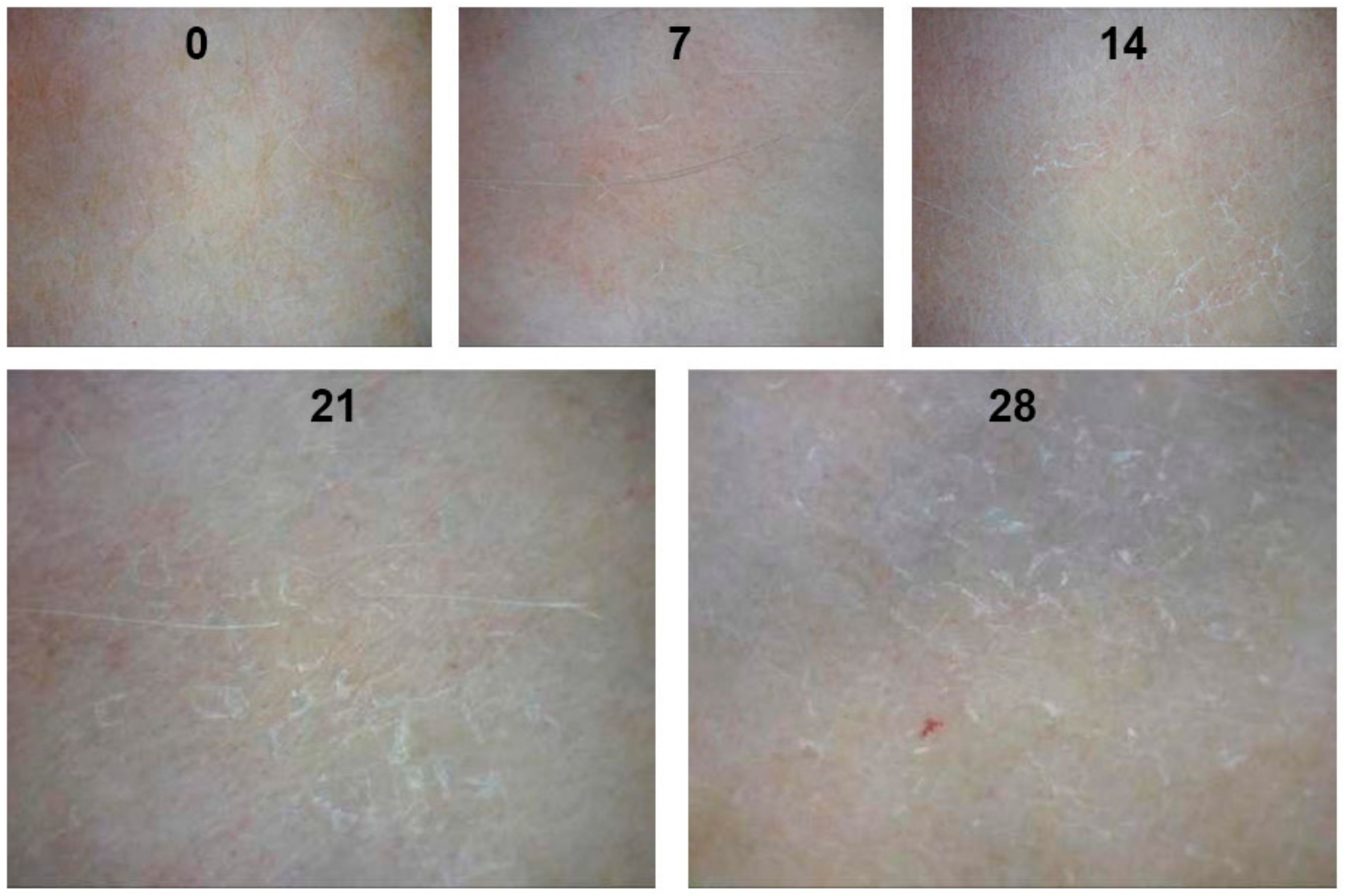 Molecules 23 01428 g004