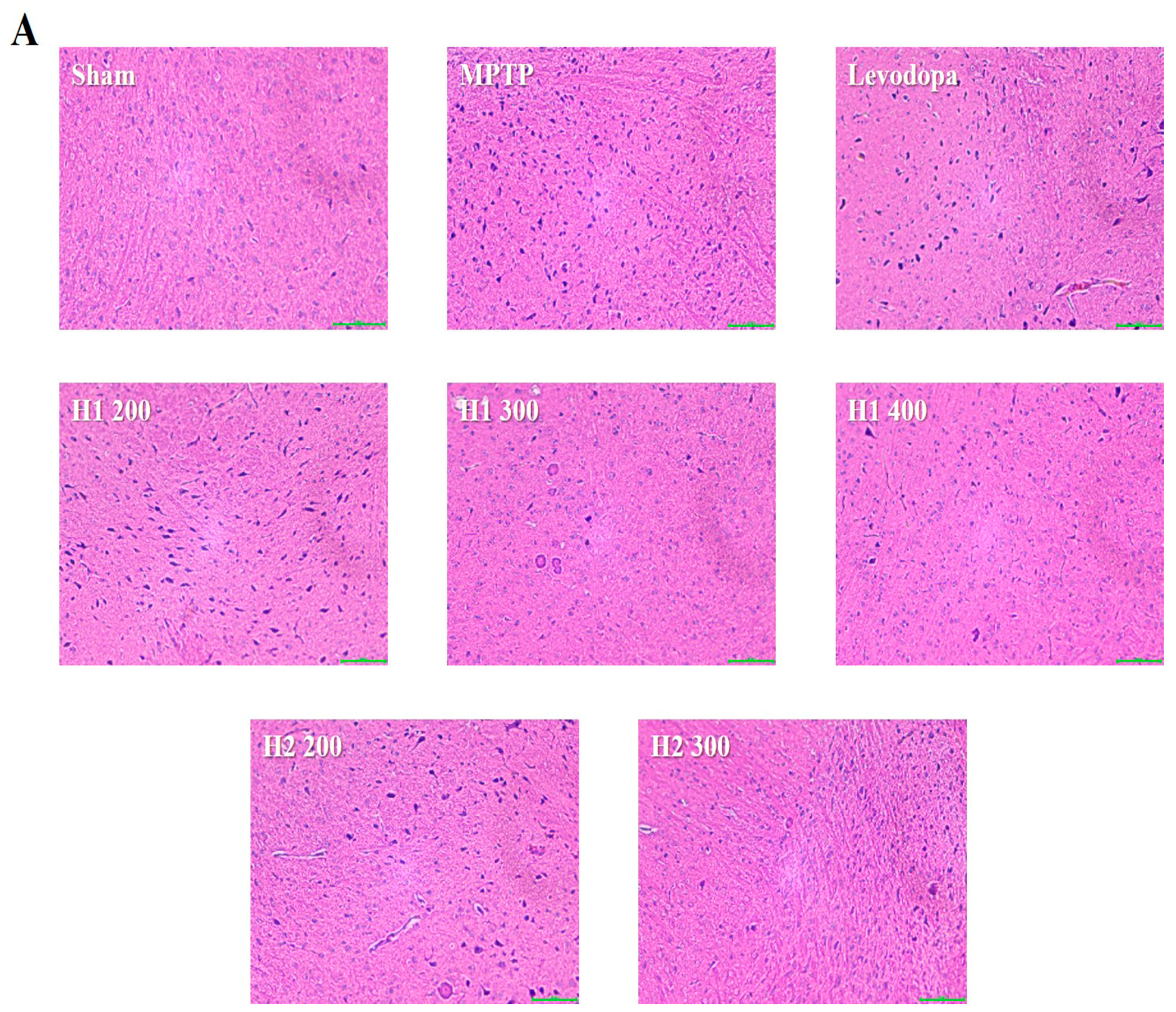 Molecules 23 02920 g004a Molecules 23 02920 g004a