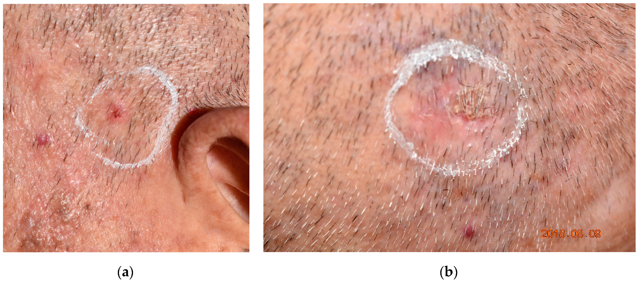Molecules 25 05195 g005