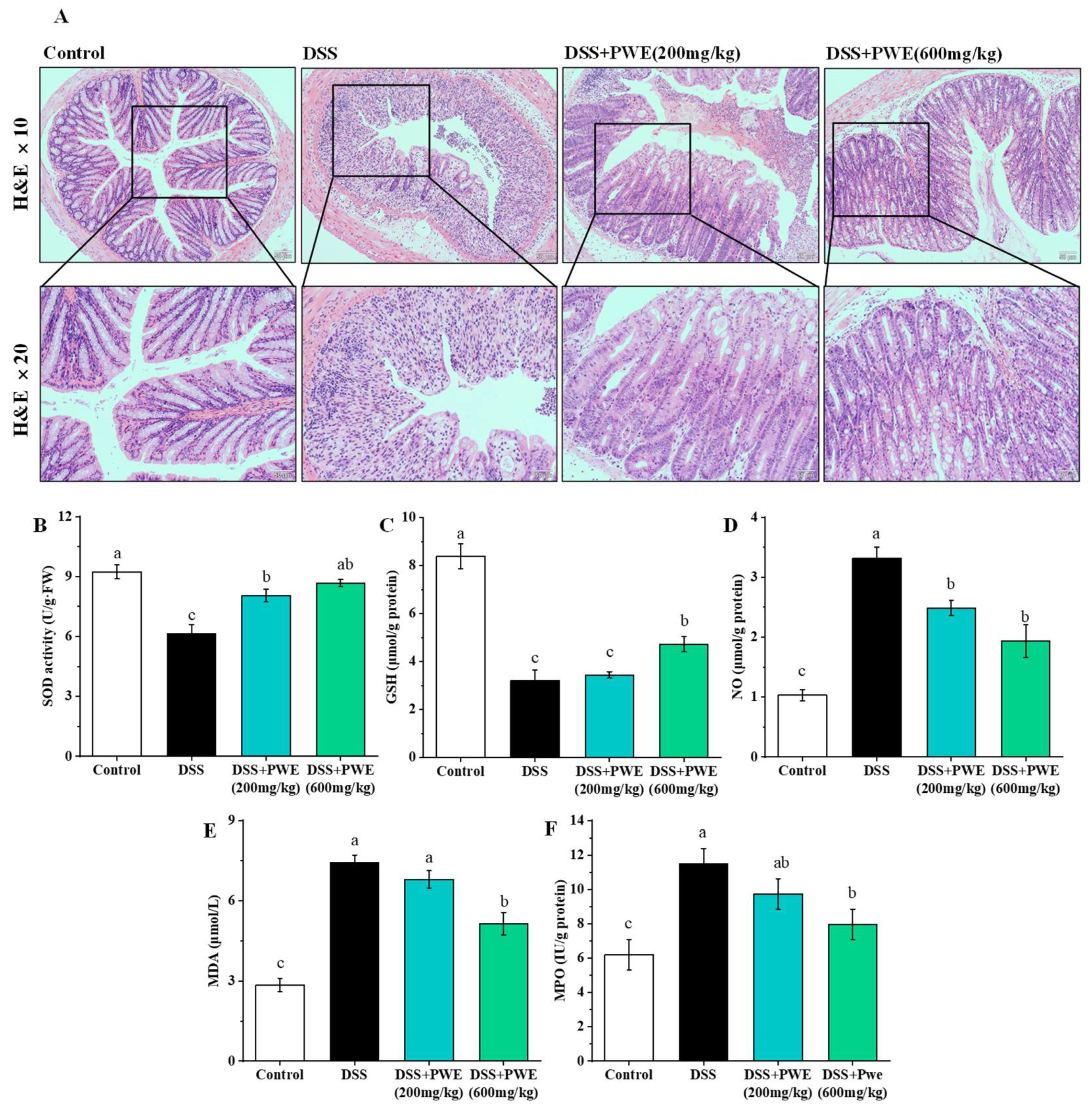 Molecules 27 03093 g005