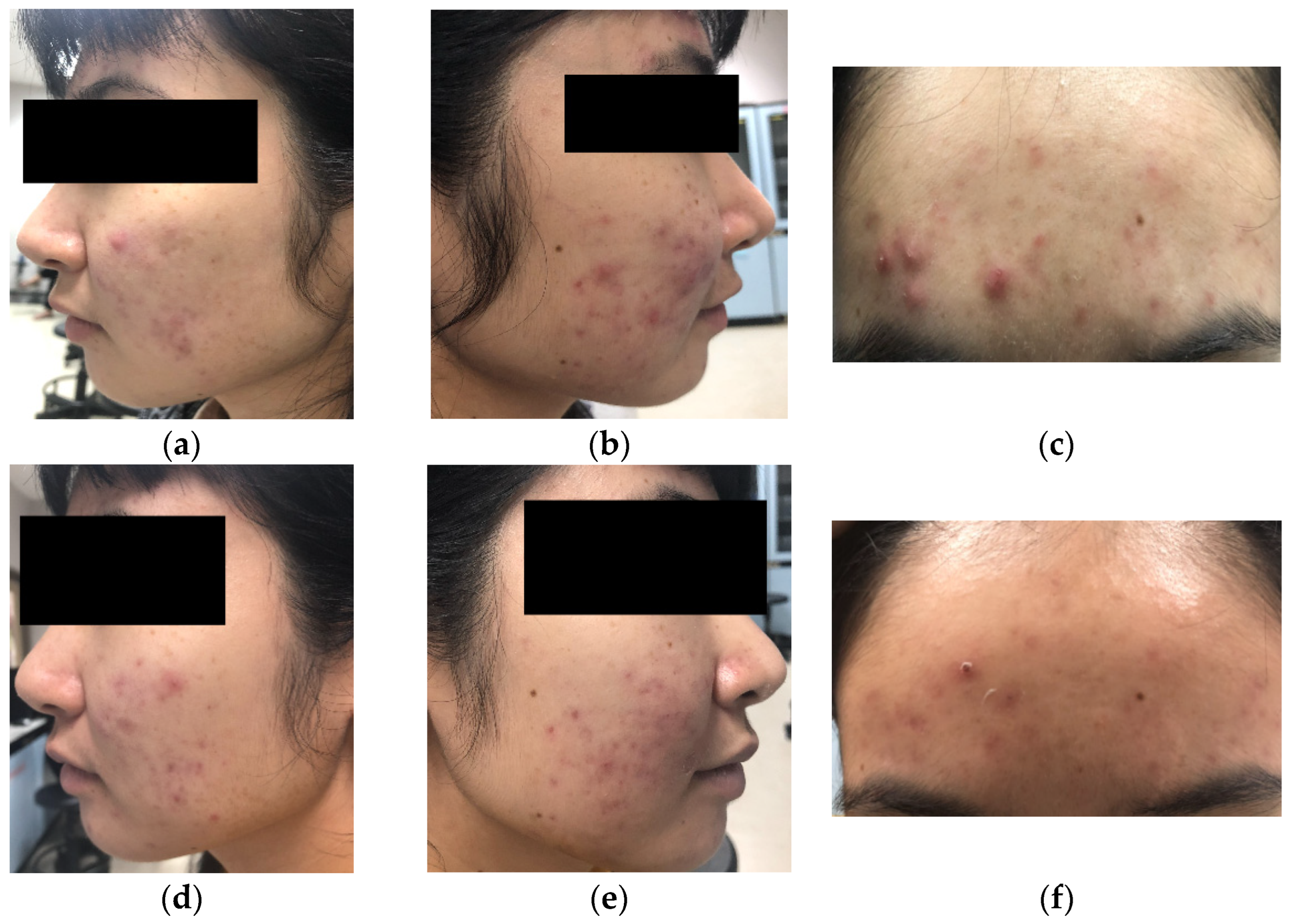 Molecules 27 04401 g005