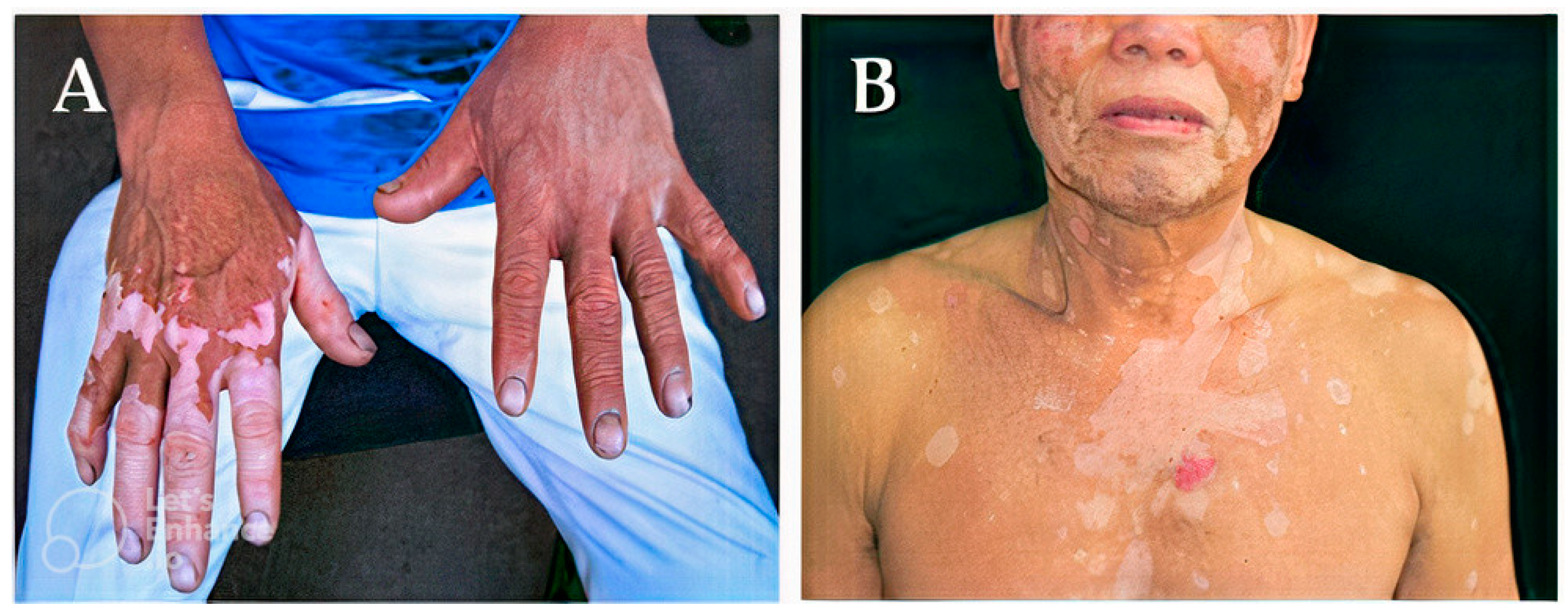 Molecules 28 04839 g005 Molecules 28 04839 g005