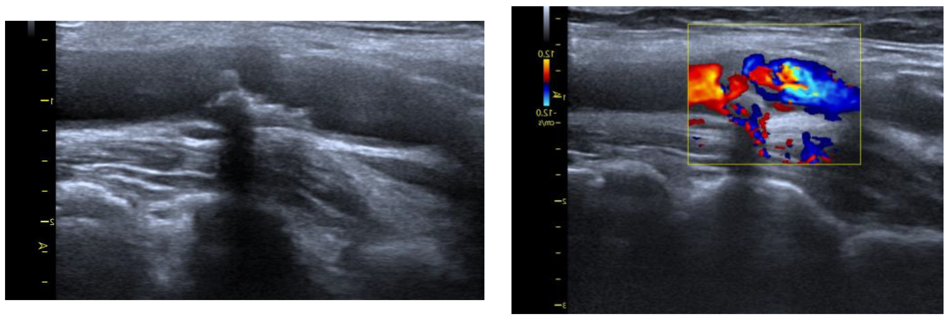 Molecules 28 05928 g003 Molecules 28 05928 g003