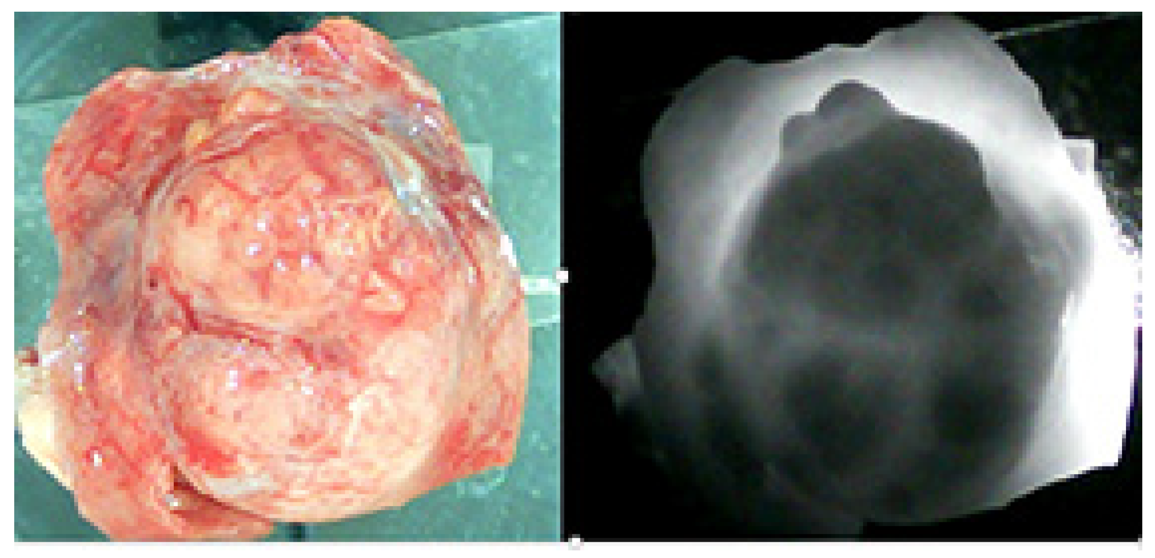 Msf 39 00004 g005 Msf 39 00004 g005