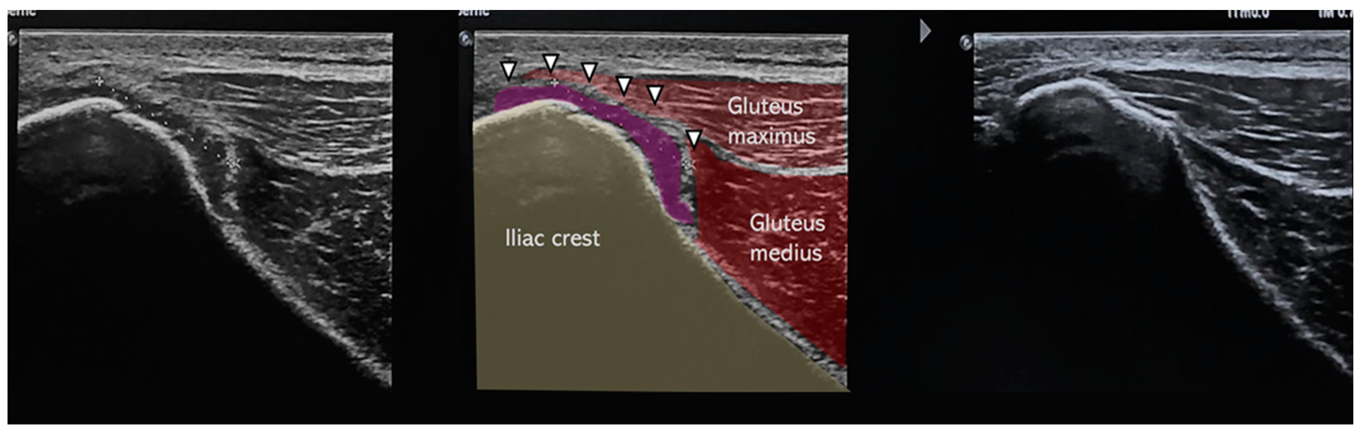 Muscles 04 00012 g003