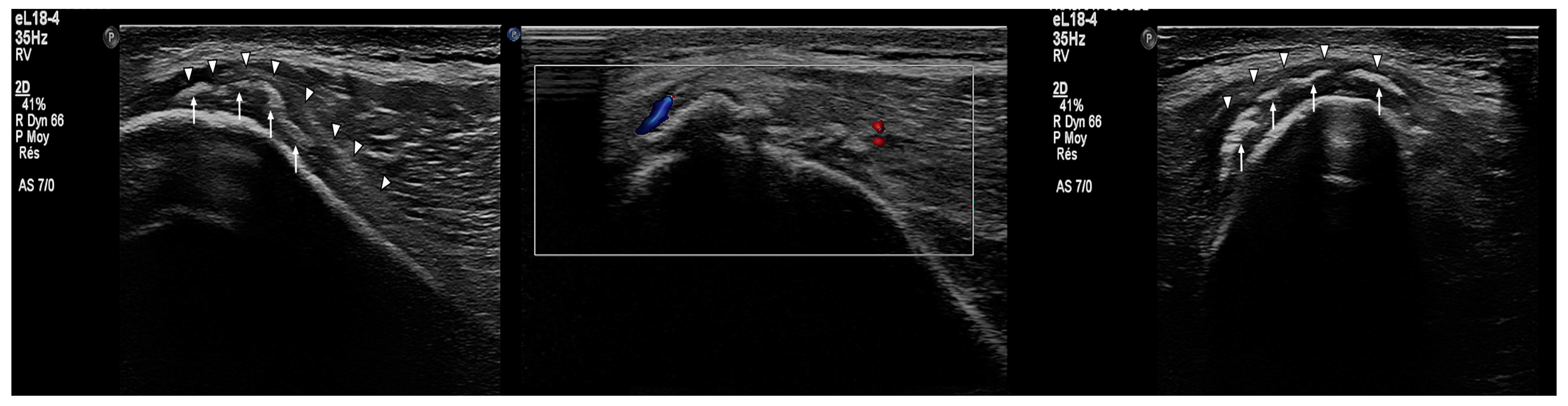 Muscles 04 00012 g005