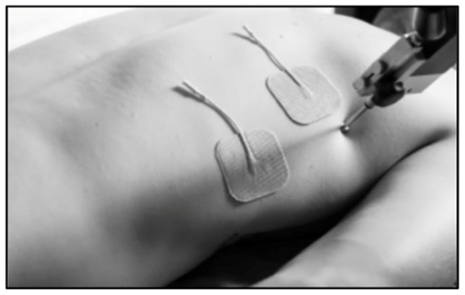 Muscles 05 00030 g003 Muscles 05 00030 g003