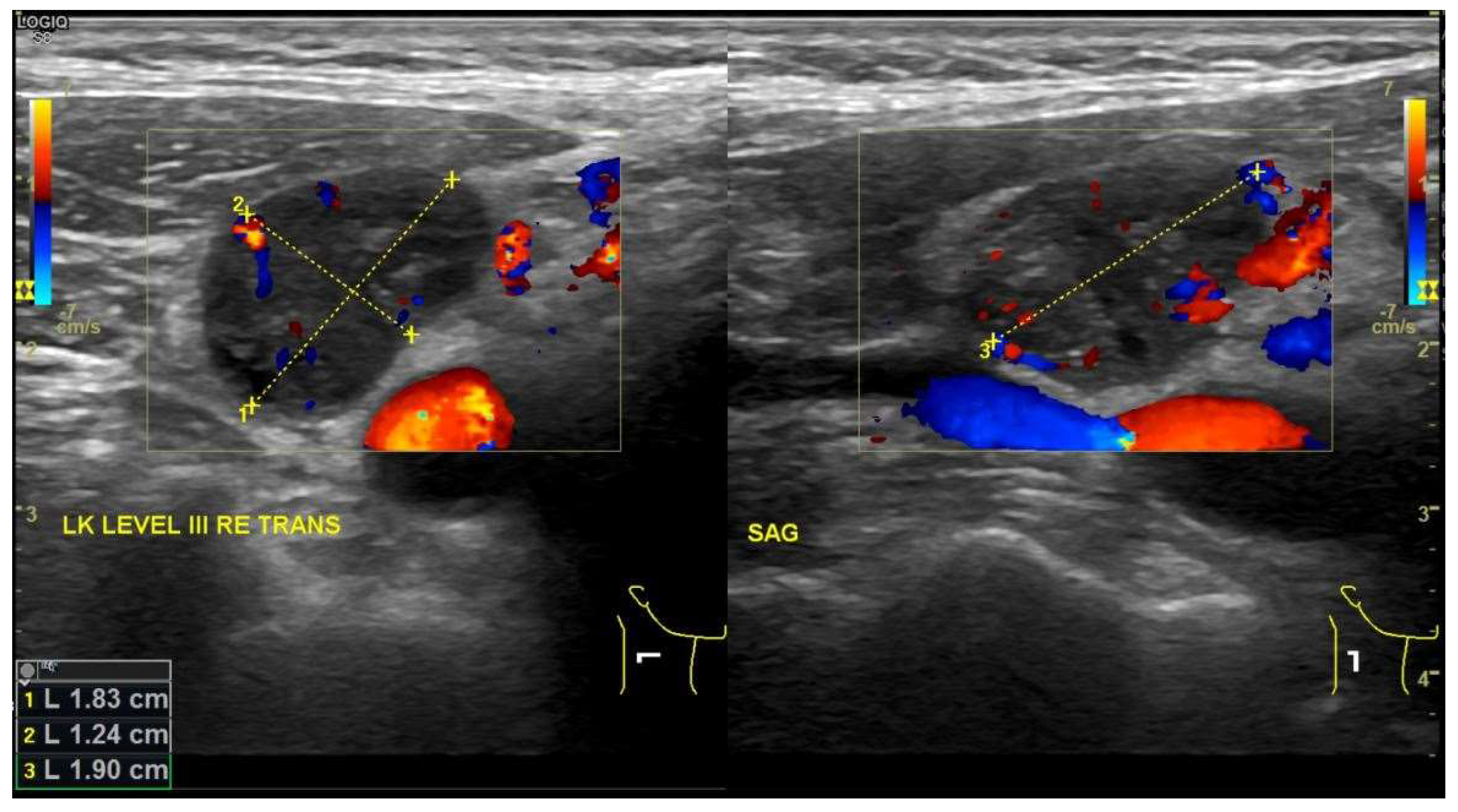 Nanomaterials 10 00383 g004 Nanomaterials 10 00383 g004