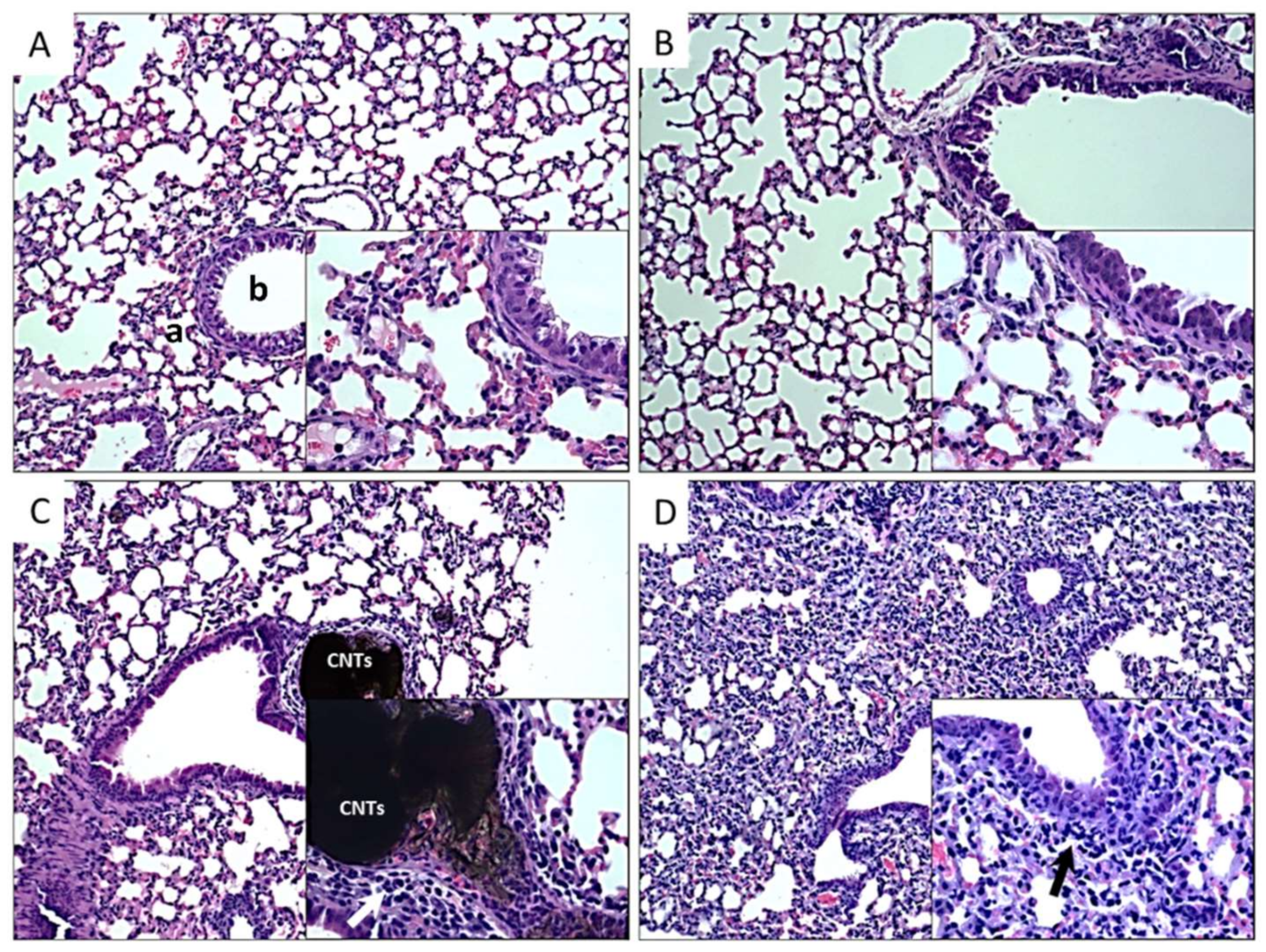Nanomaterials 10 00400 g005