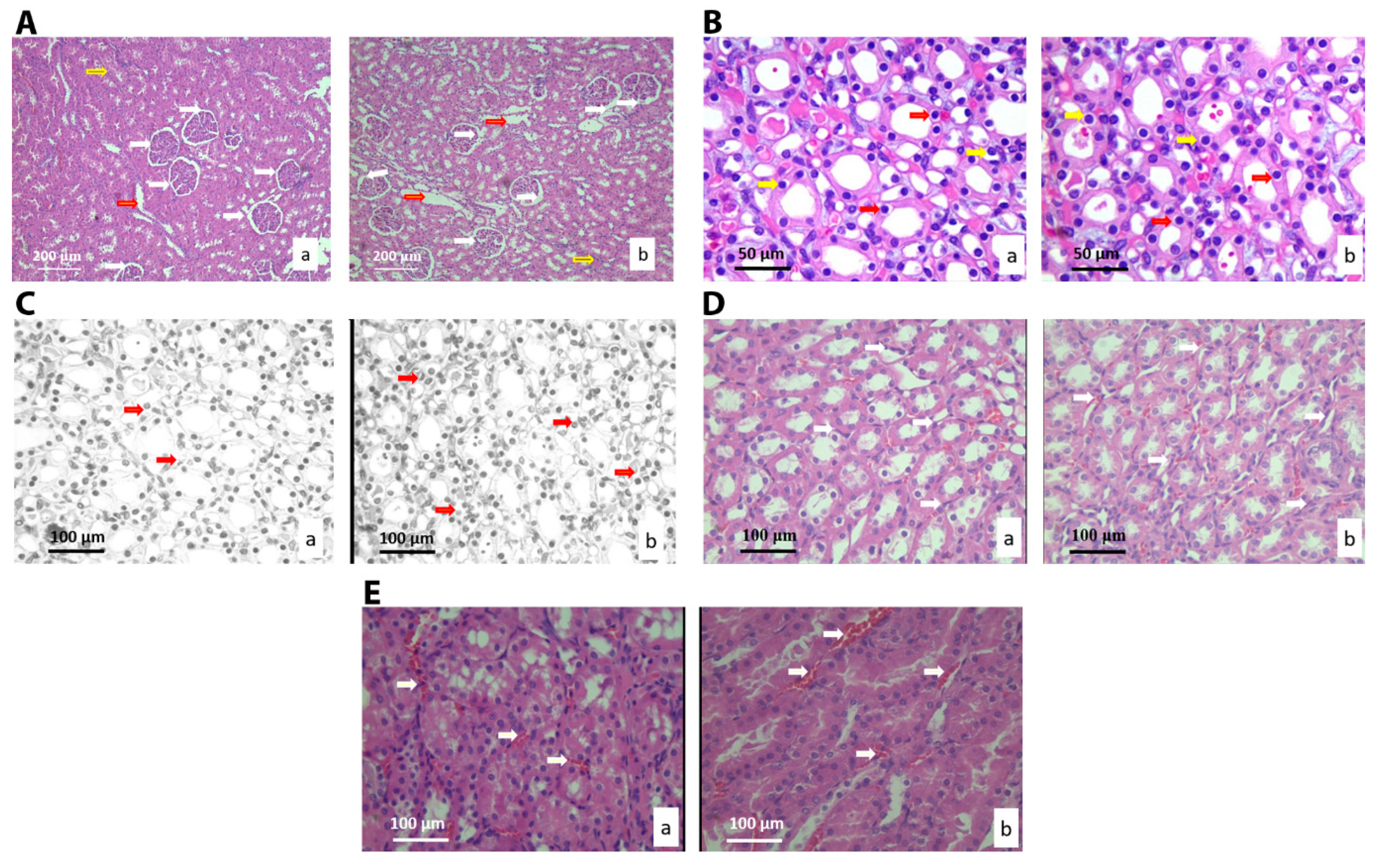 Nanomaterials 10 00918 g004