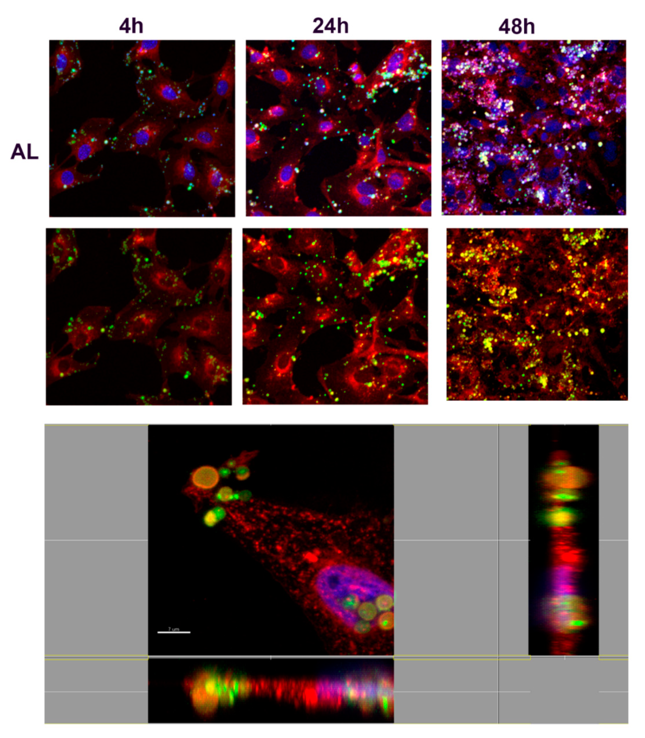 Nanomaterials 10 01075 g011
