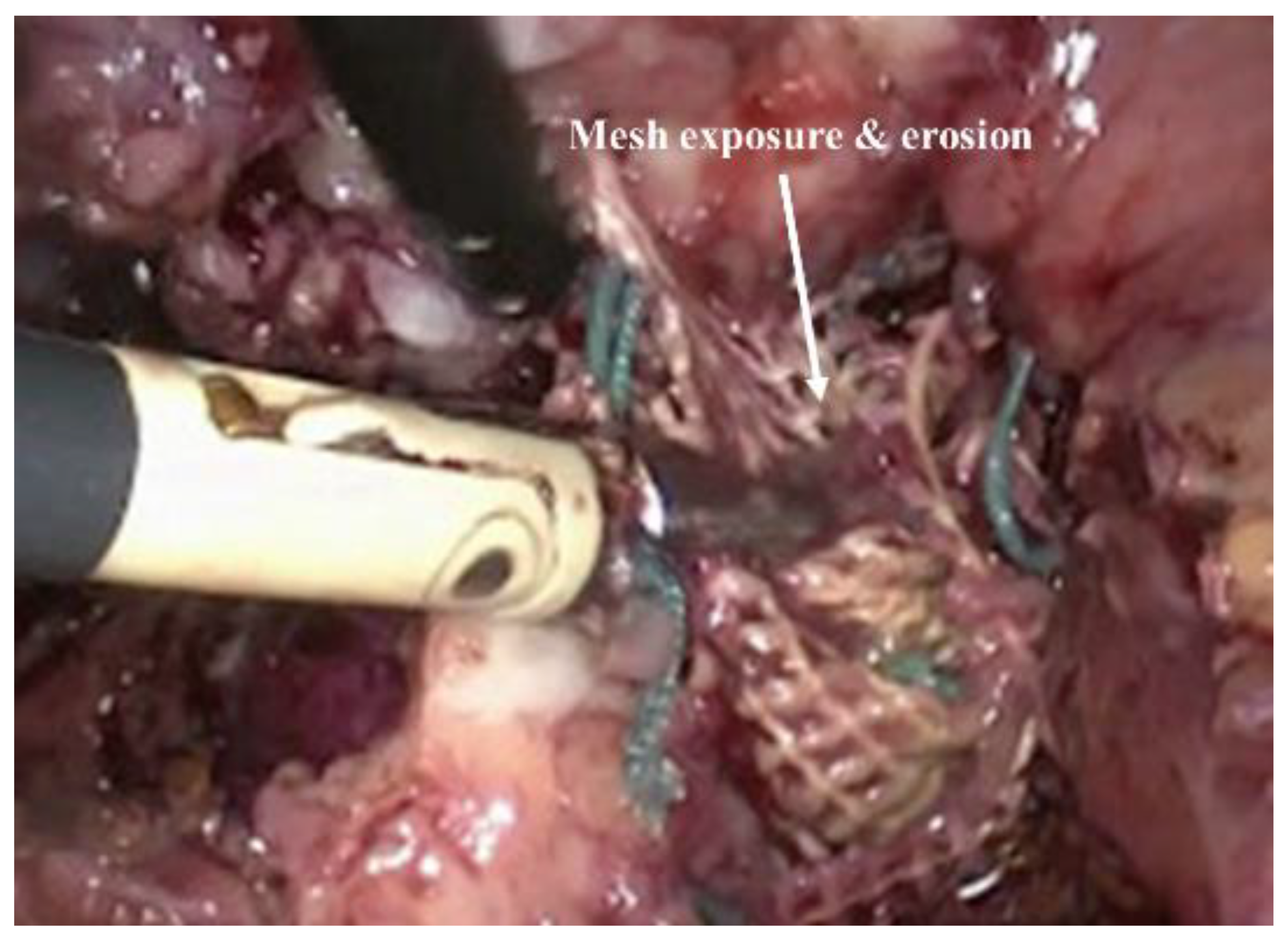 Nanomaterials 10 01120 g003