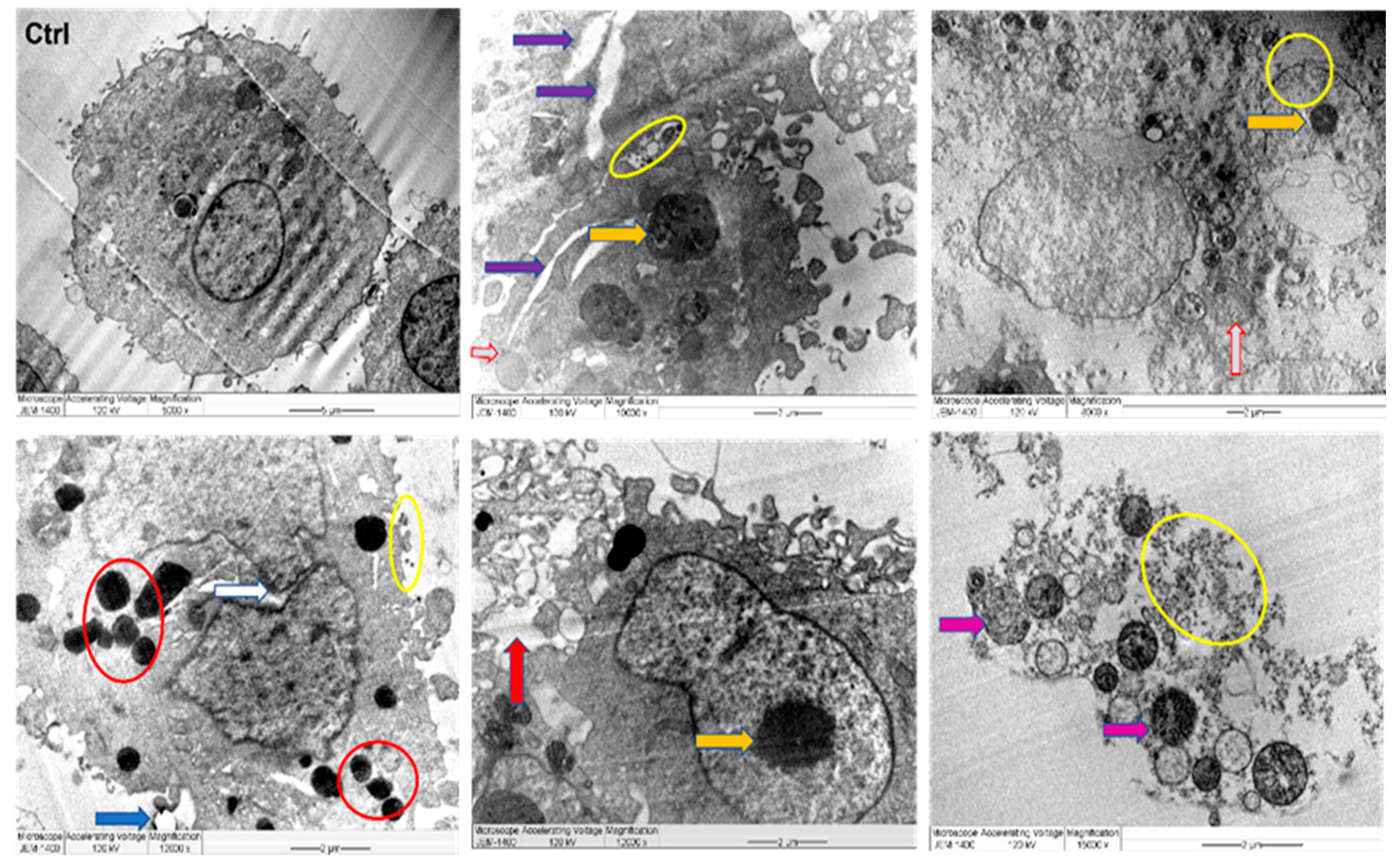 Nanomaterials 11 02400 g011