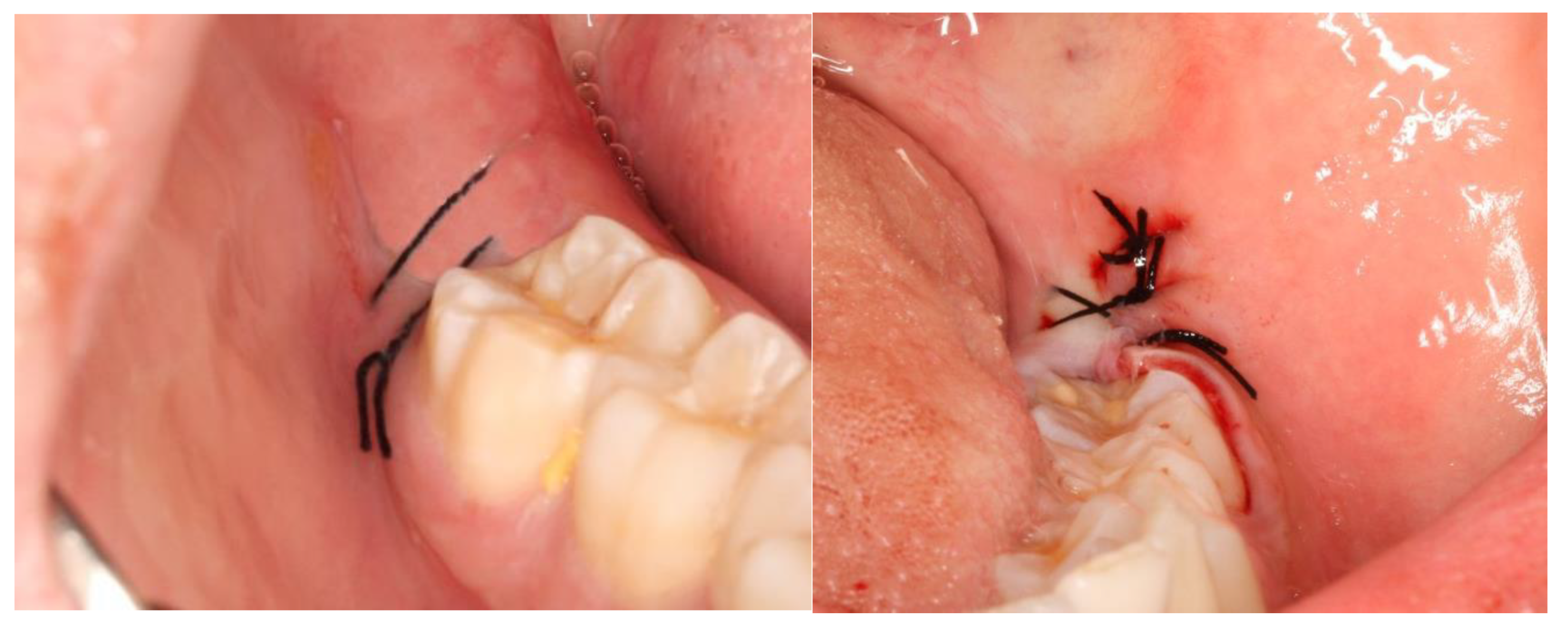 Nanomaterials 13 00706 g005