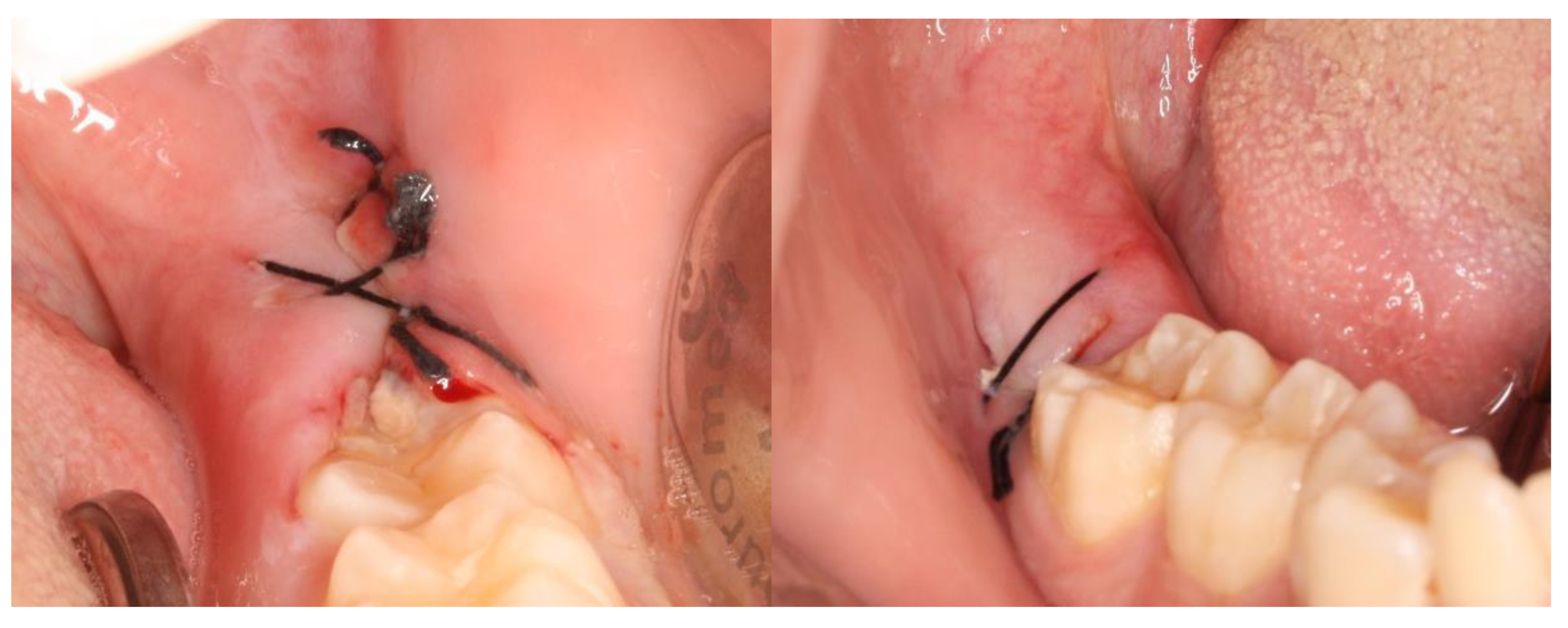 Nanomaterials 13 00706 g008