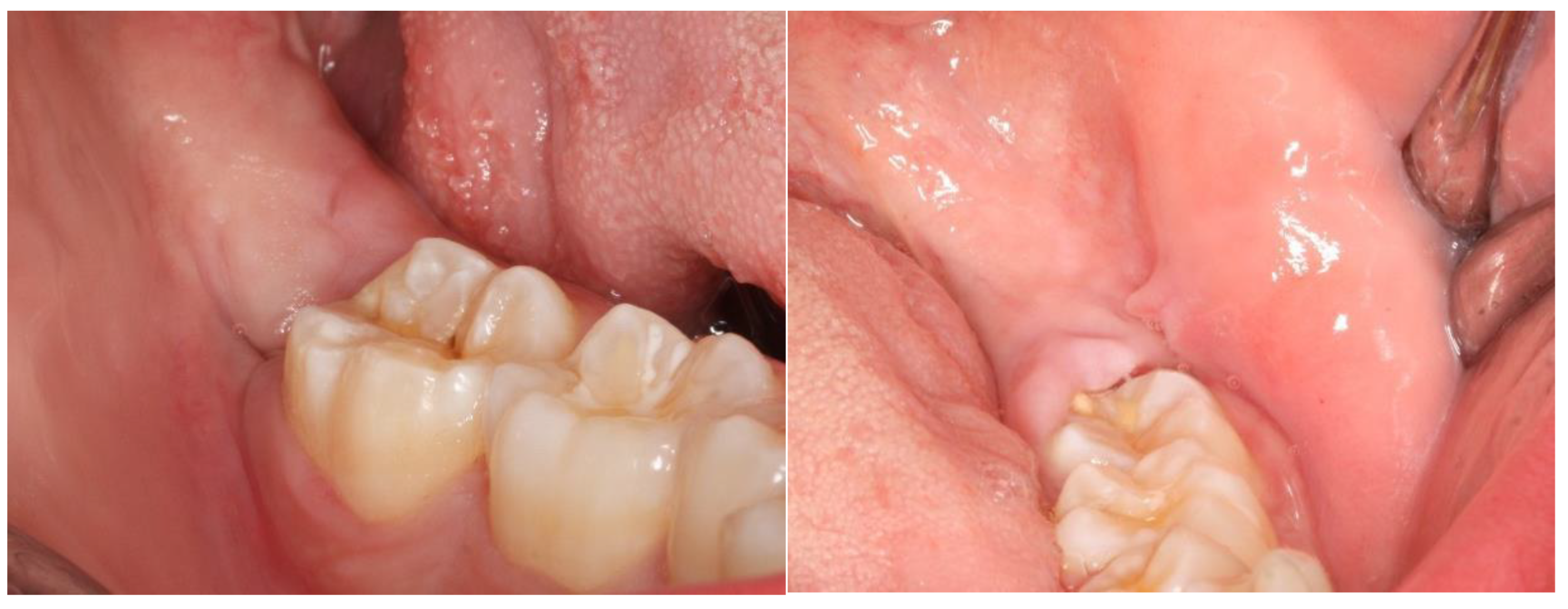 Nanomaterials 13 00706 g009