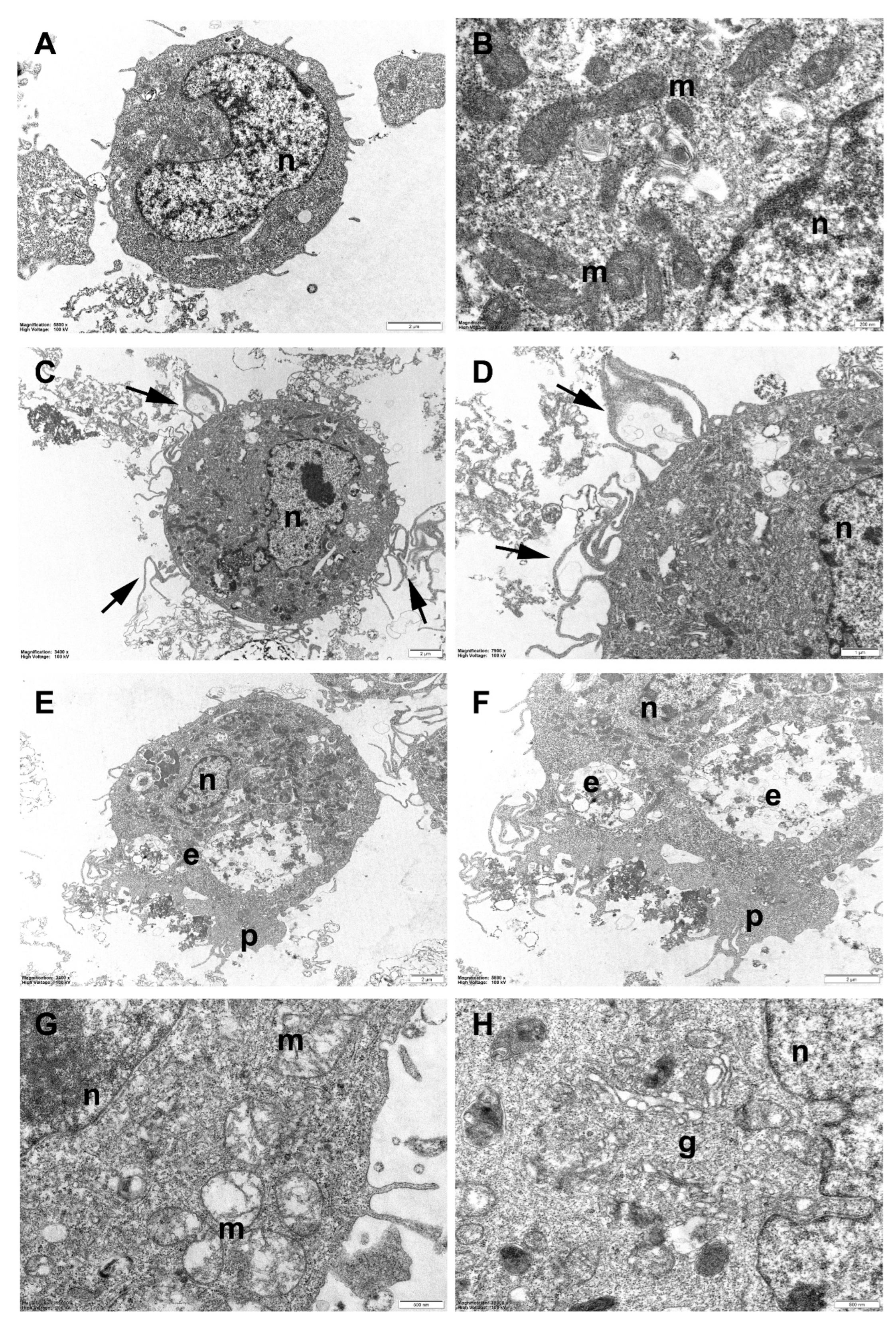 Nanomaterials 13 00756 g006