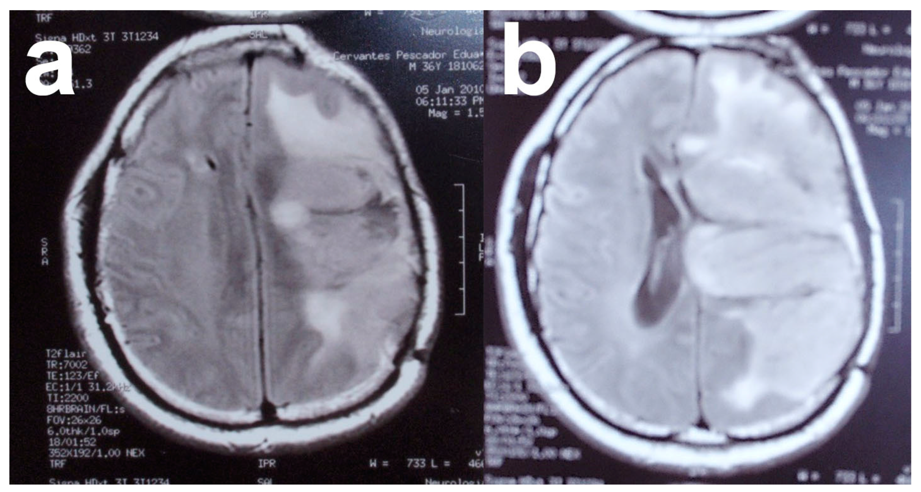 Nanomaterials 13 01541 g006 Nanomaterials 13 01541 g006