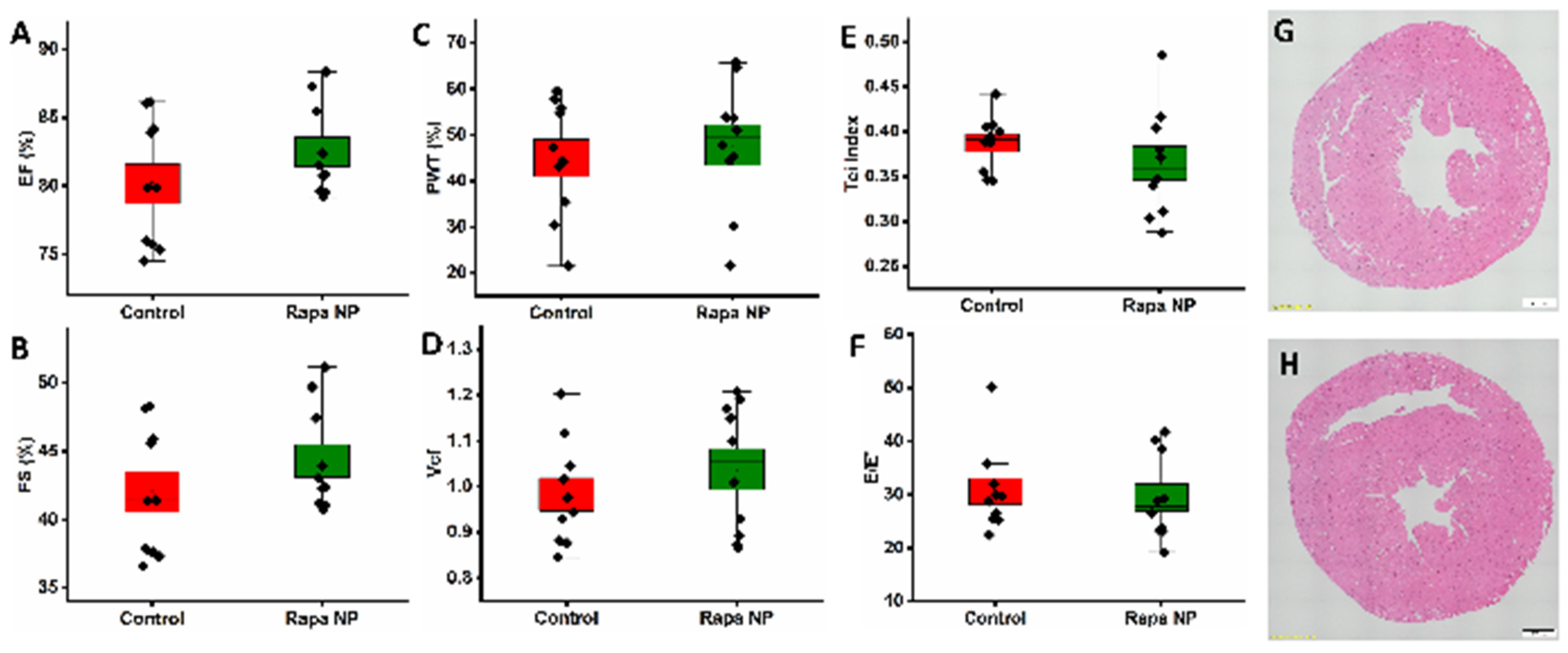 Nanomaterials 14 01752 g002