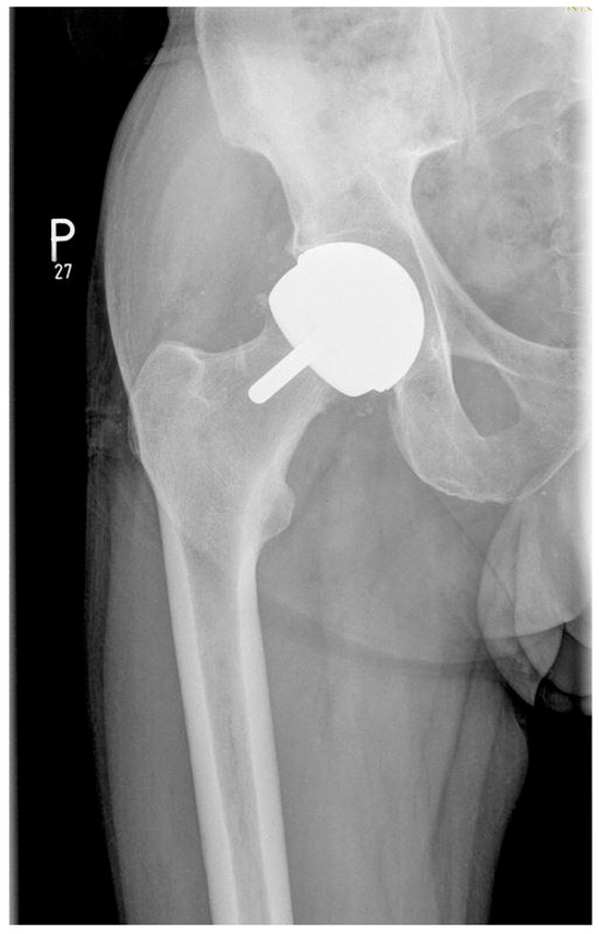 Nanomaterials 15 01258 g002