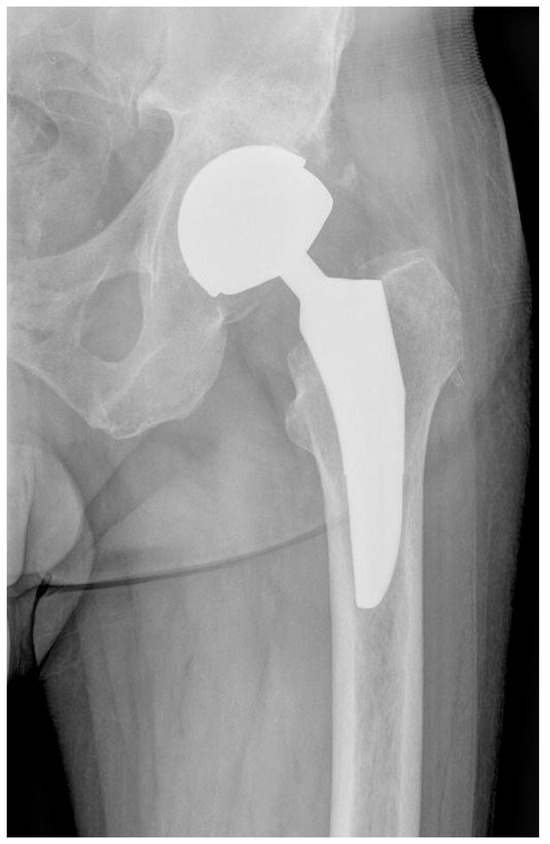 Nanomaterials 15 01258 g003