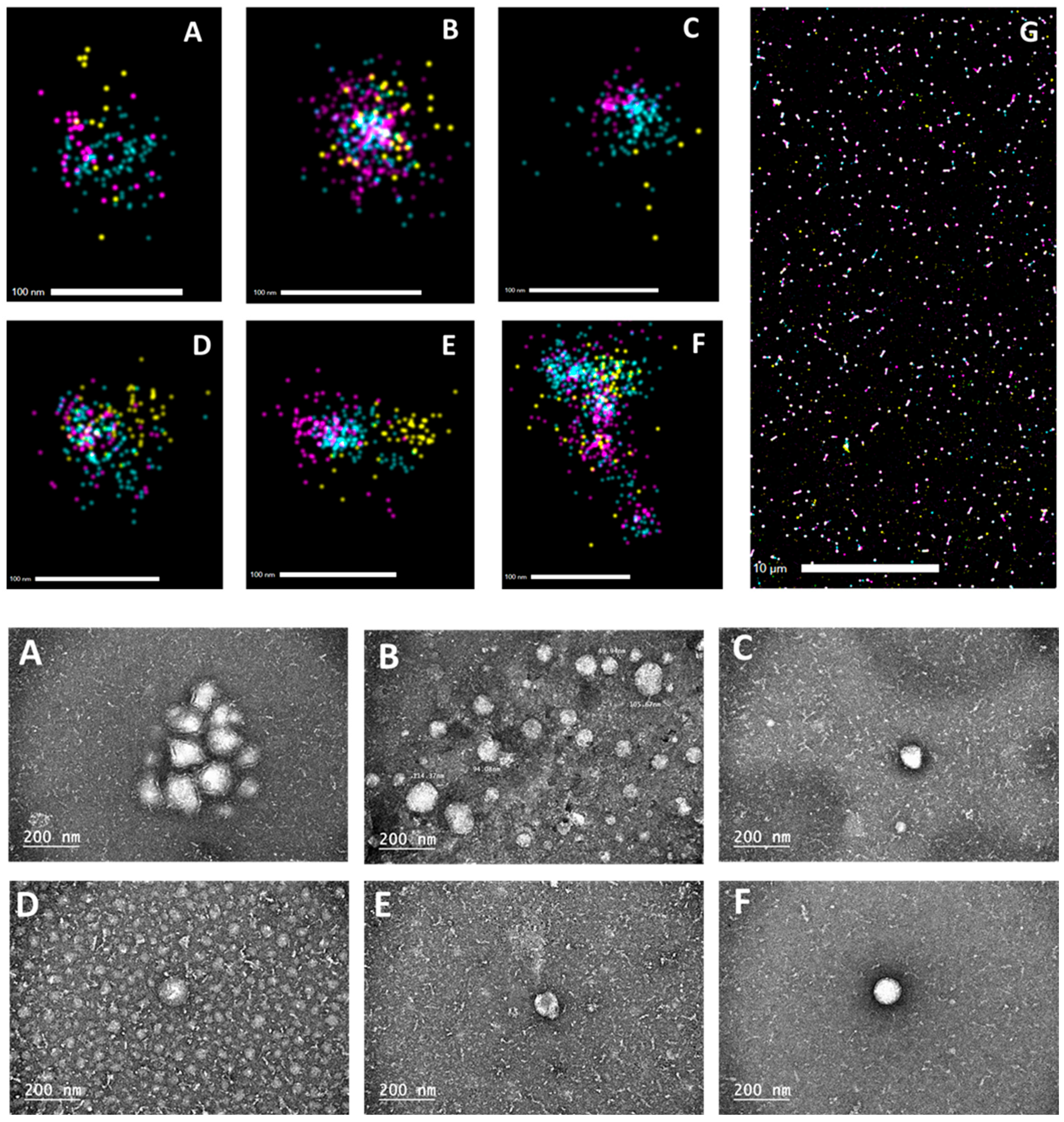 Particle Distribution Visualization Functional and Molecular Characterization of Extracellular Vesicles ...