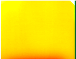 Ndt 02 00031 i025 Ndt 02 00031 i025