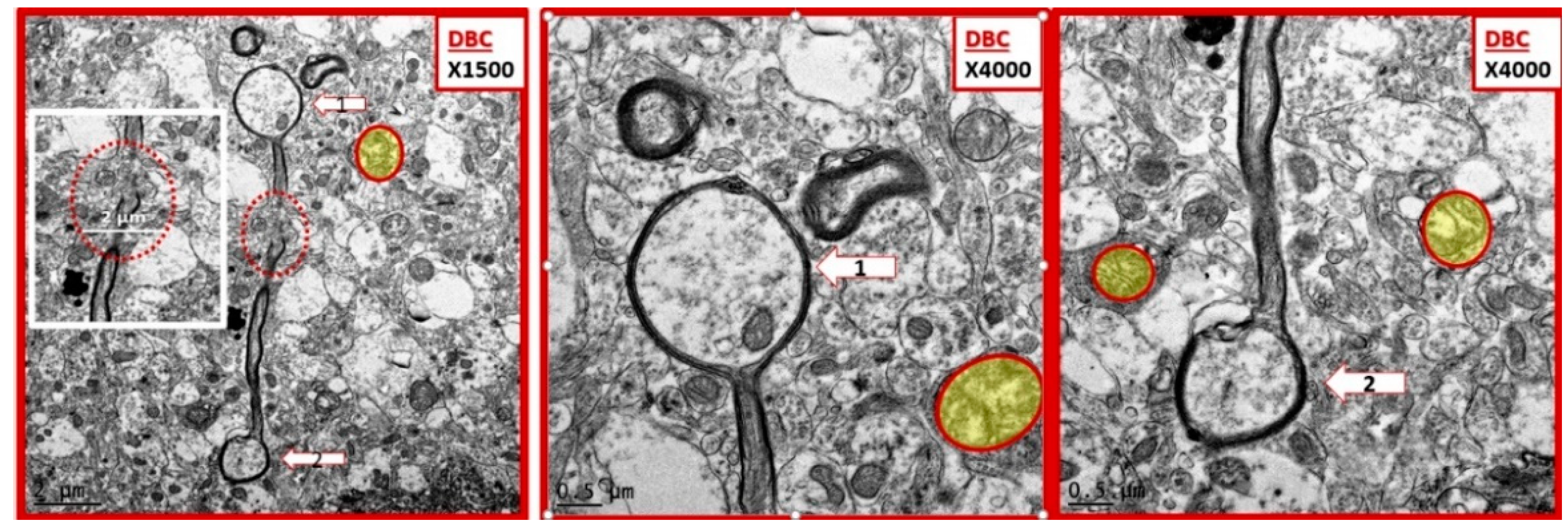 Neuroglia 01 00024 g004