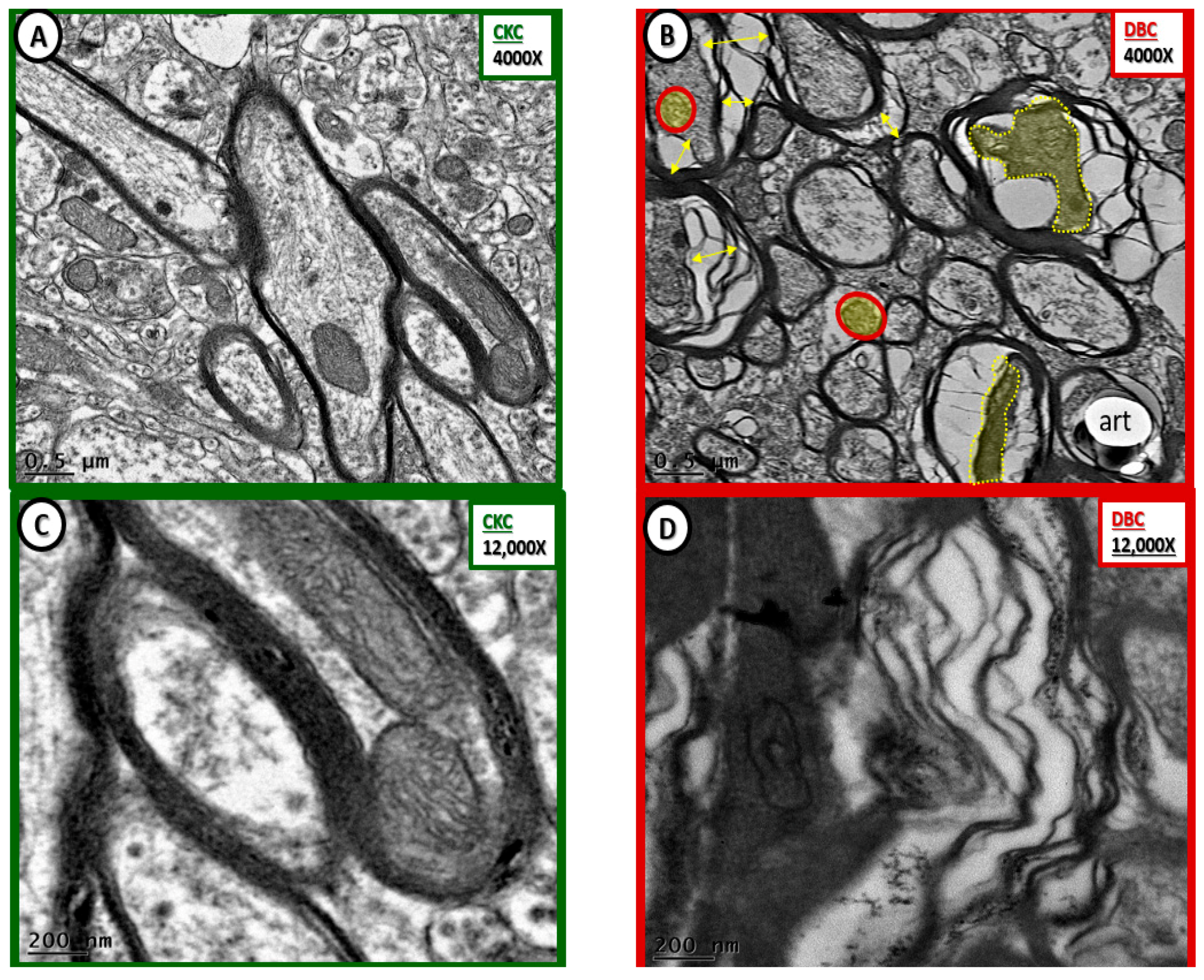 Neuroglia 01 00024 g008