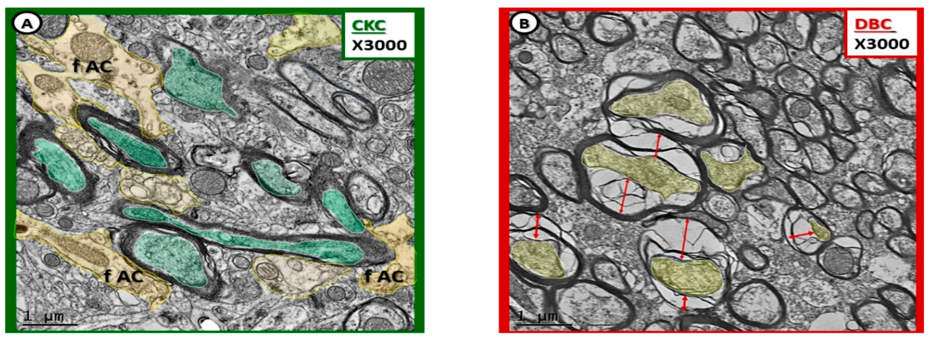 Neuroglia 01 00024 g010