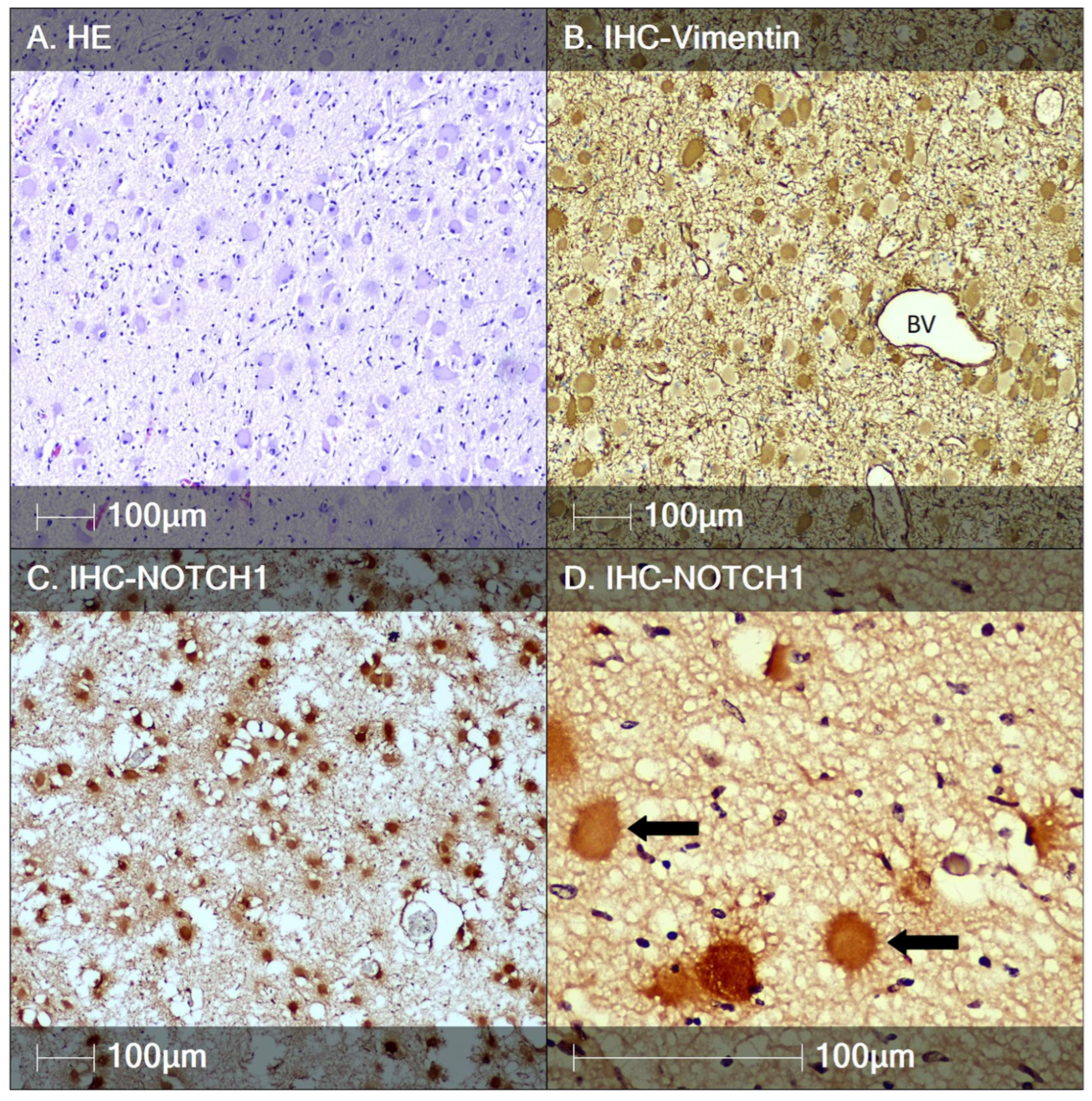 Neuroglia 06 00007 g004