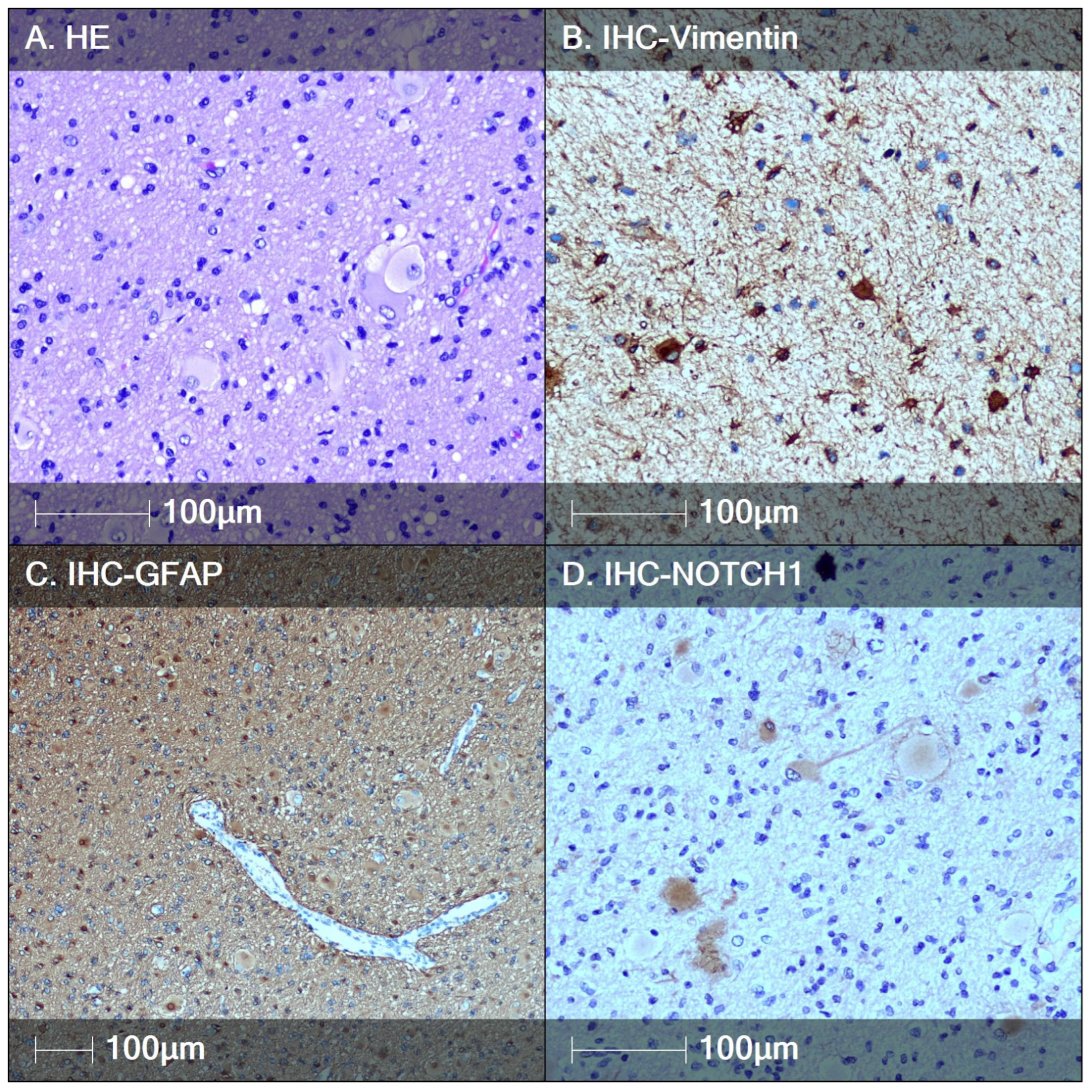 Neuroglia 06 00007 g005