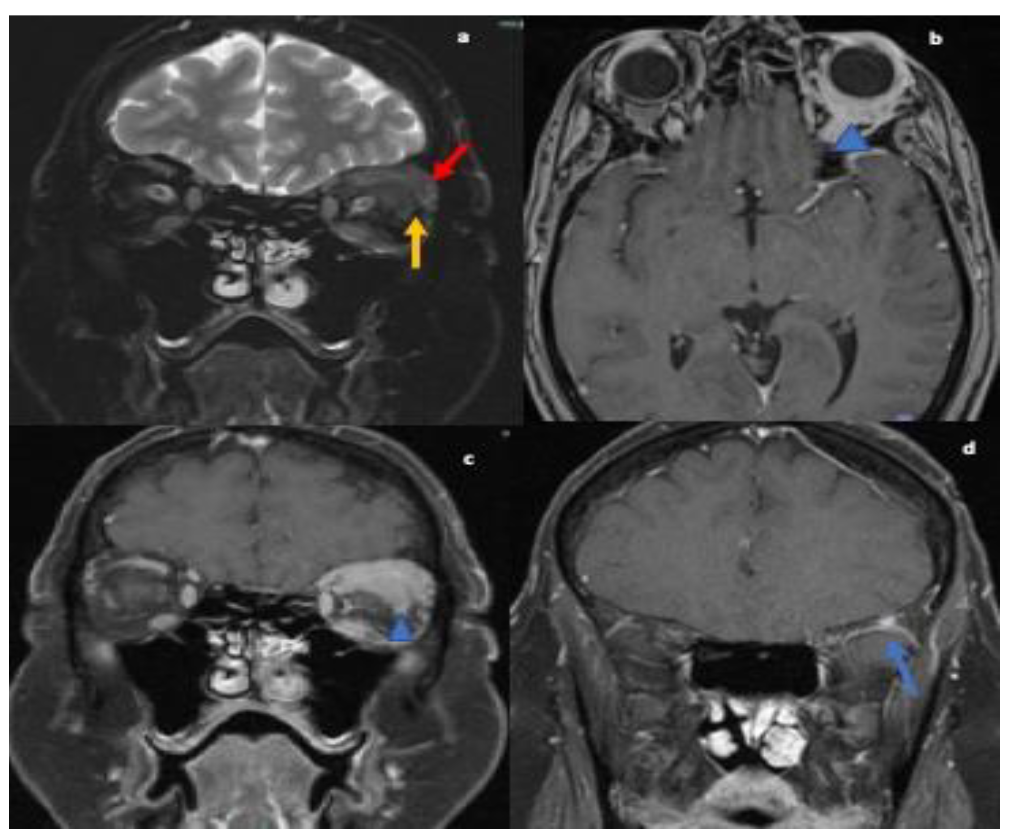 Neurolint 13 00013 g002 Neurolint 13 00013 g002