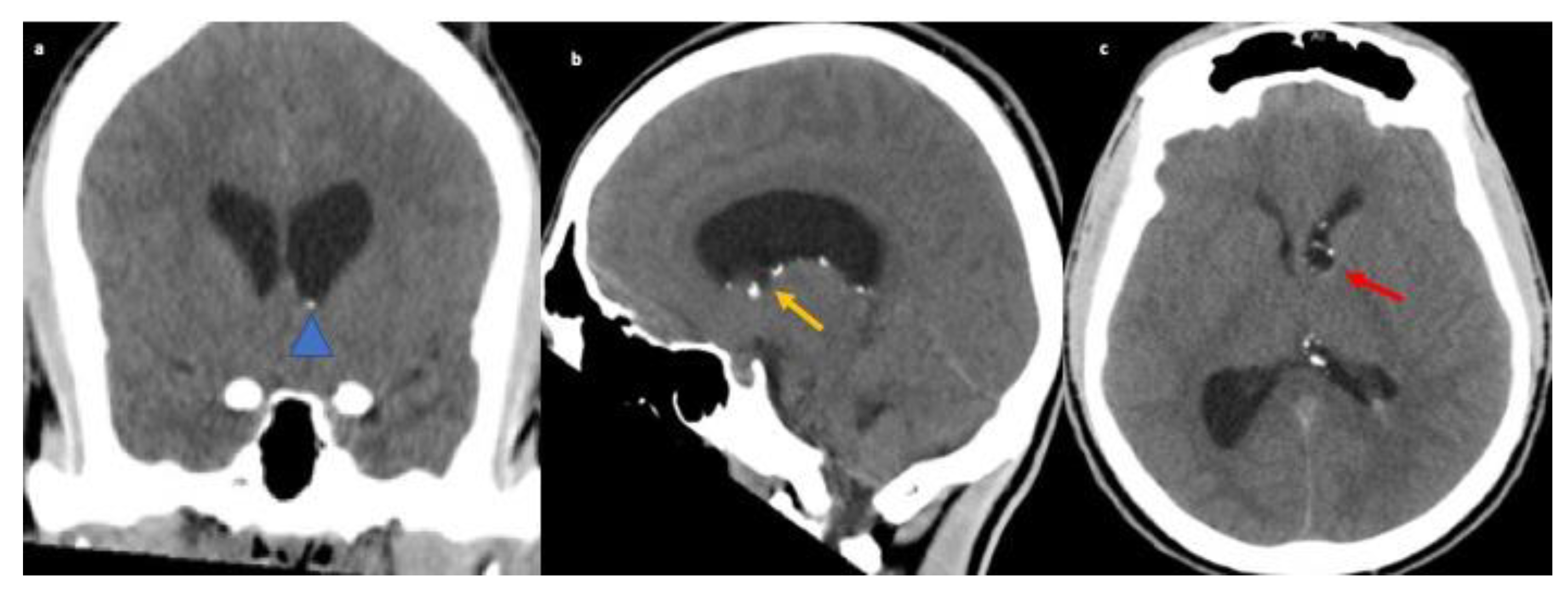 Neurolint 13 00013 g003 Neurolint 13 00013 g003