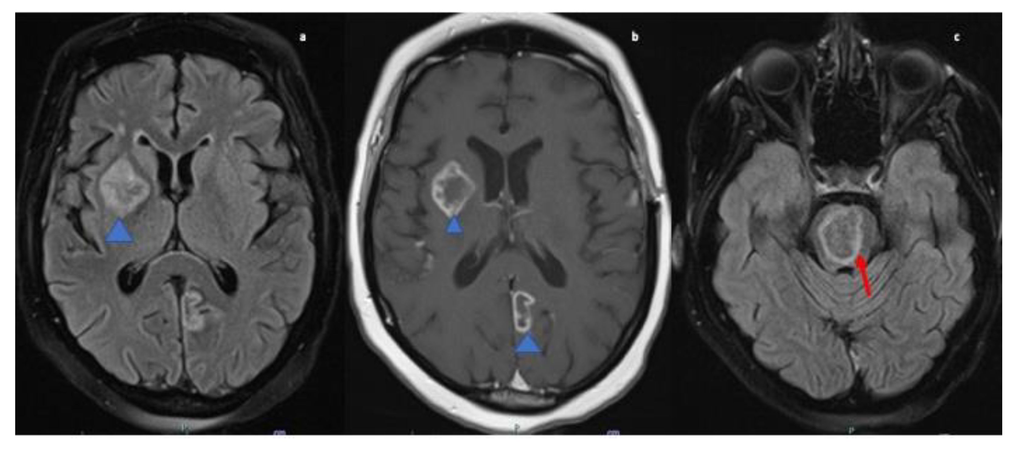 Neurolint 13 00013 g004 Neurolint 13 00013 g004