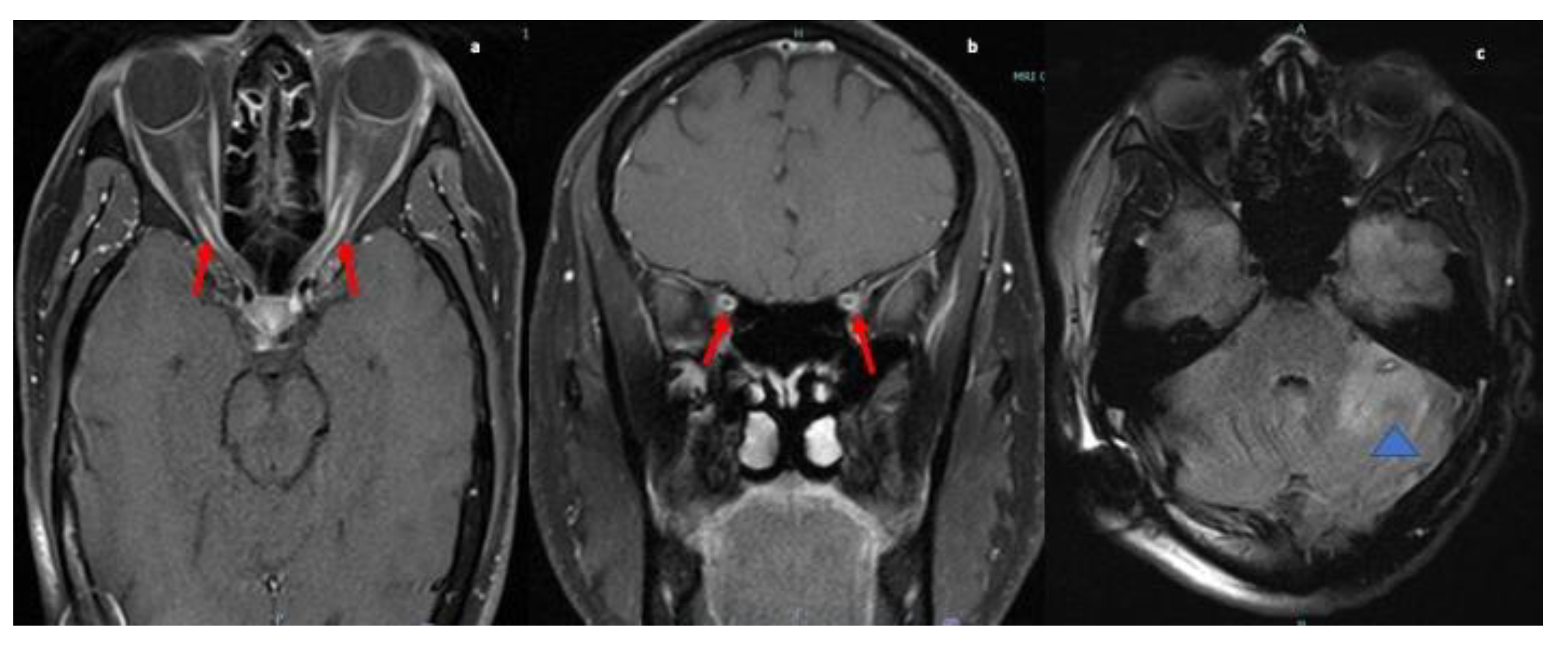 Neurolint 13 00013 g005 Neurolint 13 00013 g005