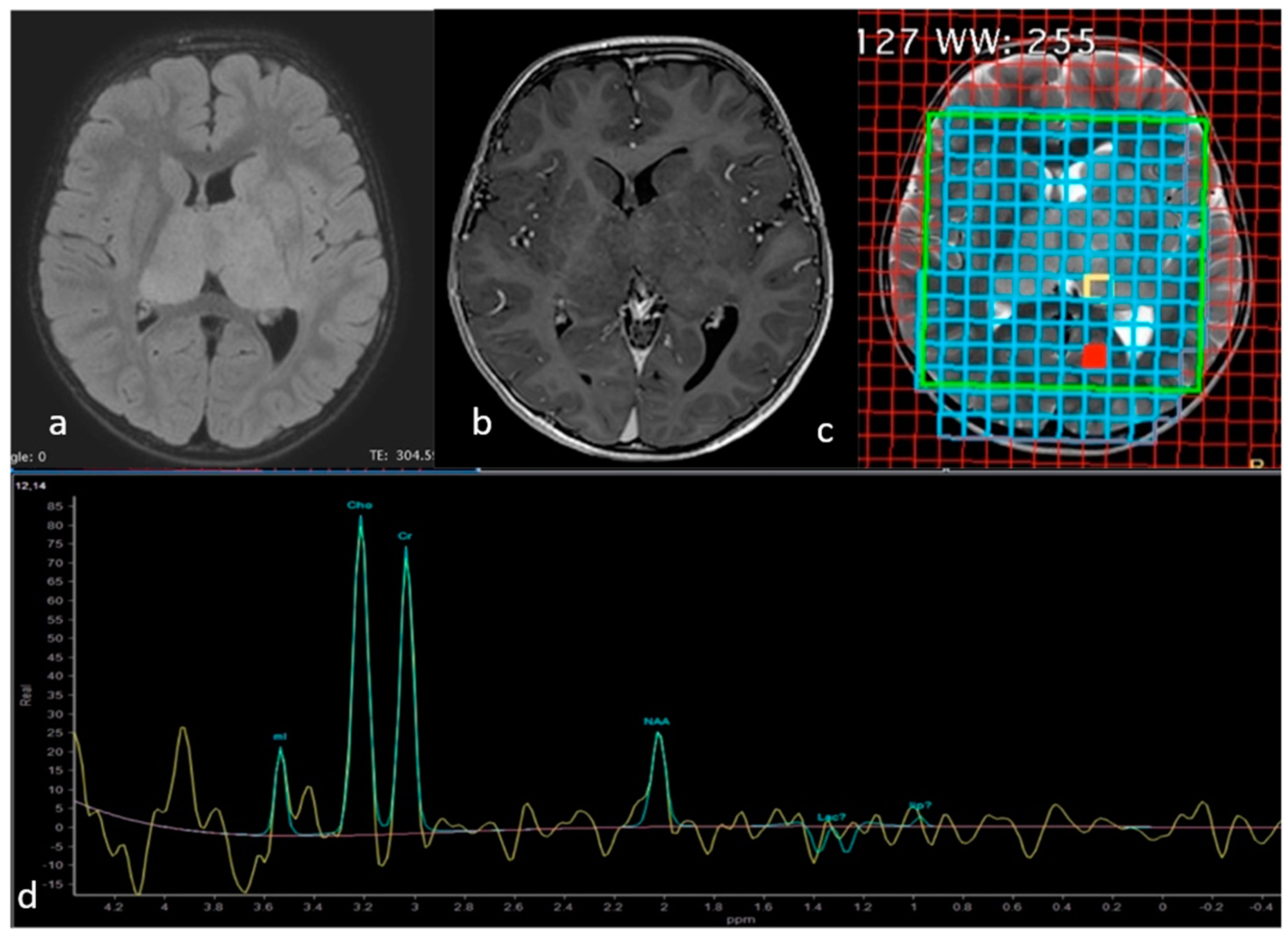 Neurolint 13 00017 g002
