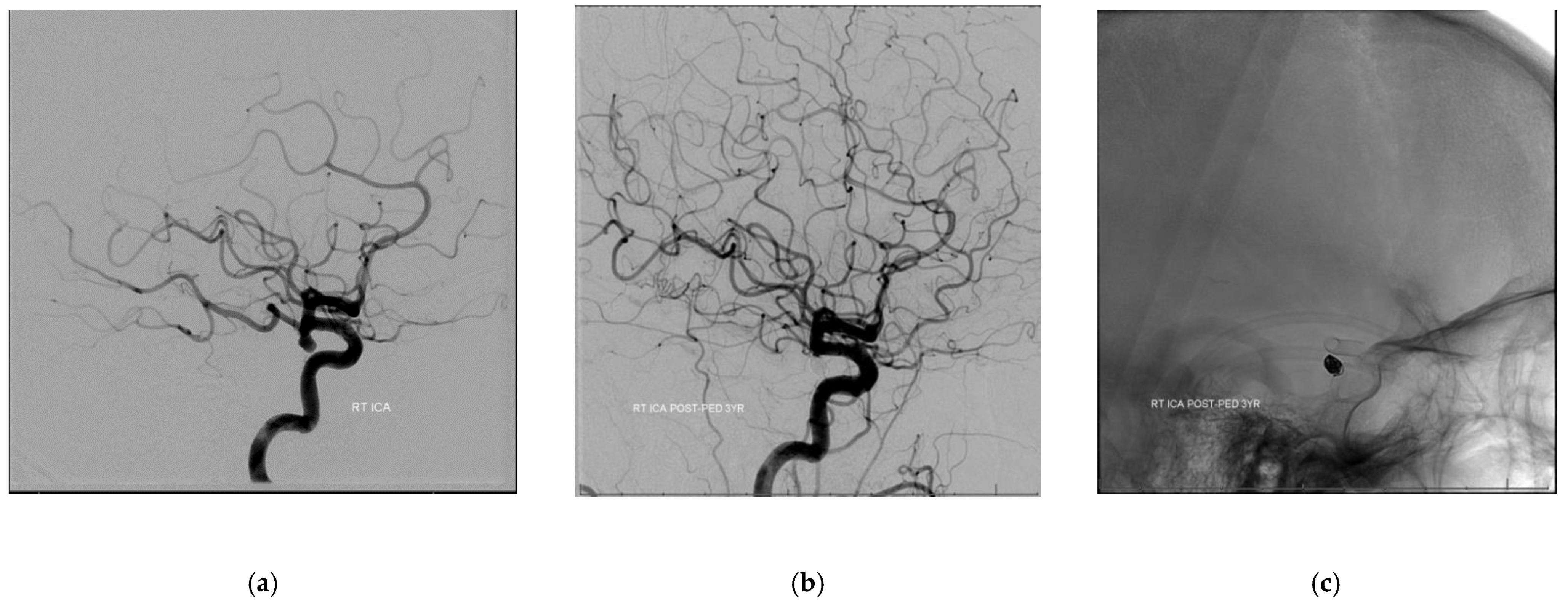 Neurolint 13 00020 g001a