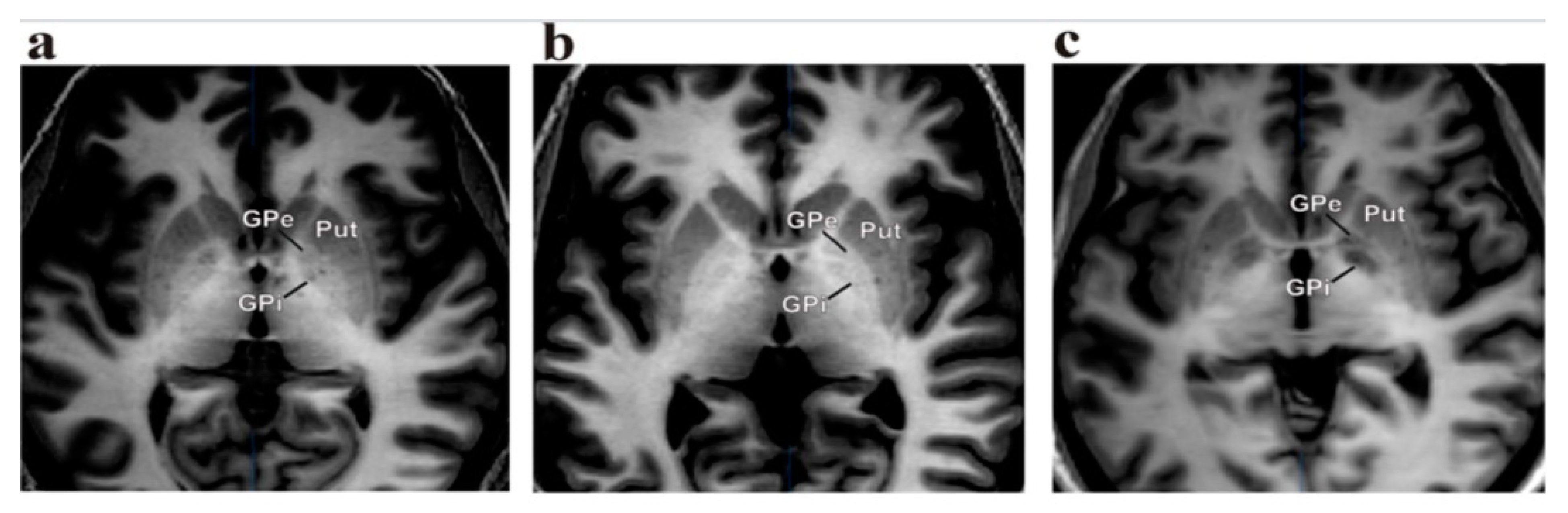 Neurolint 13 00037 g001