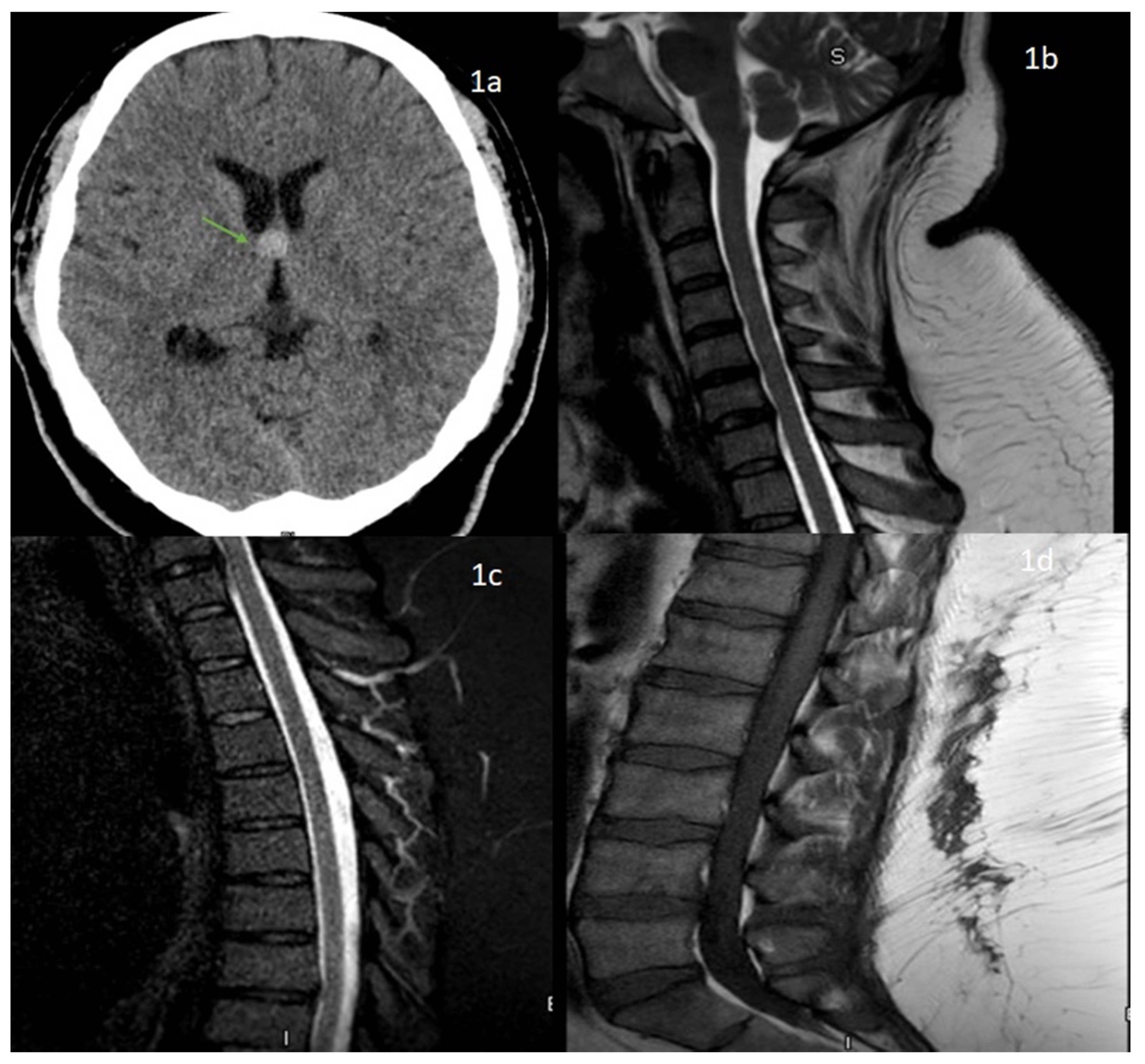 Neurolint 13 00040 g001